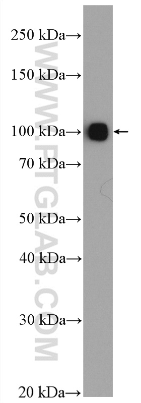 WB analysis of human plasma using 26768-1-AP