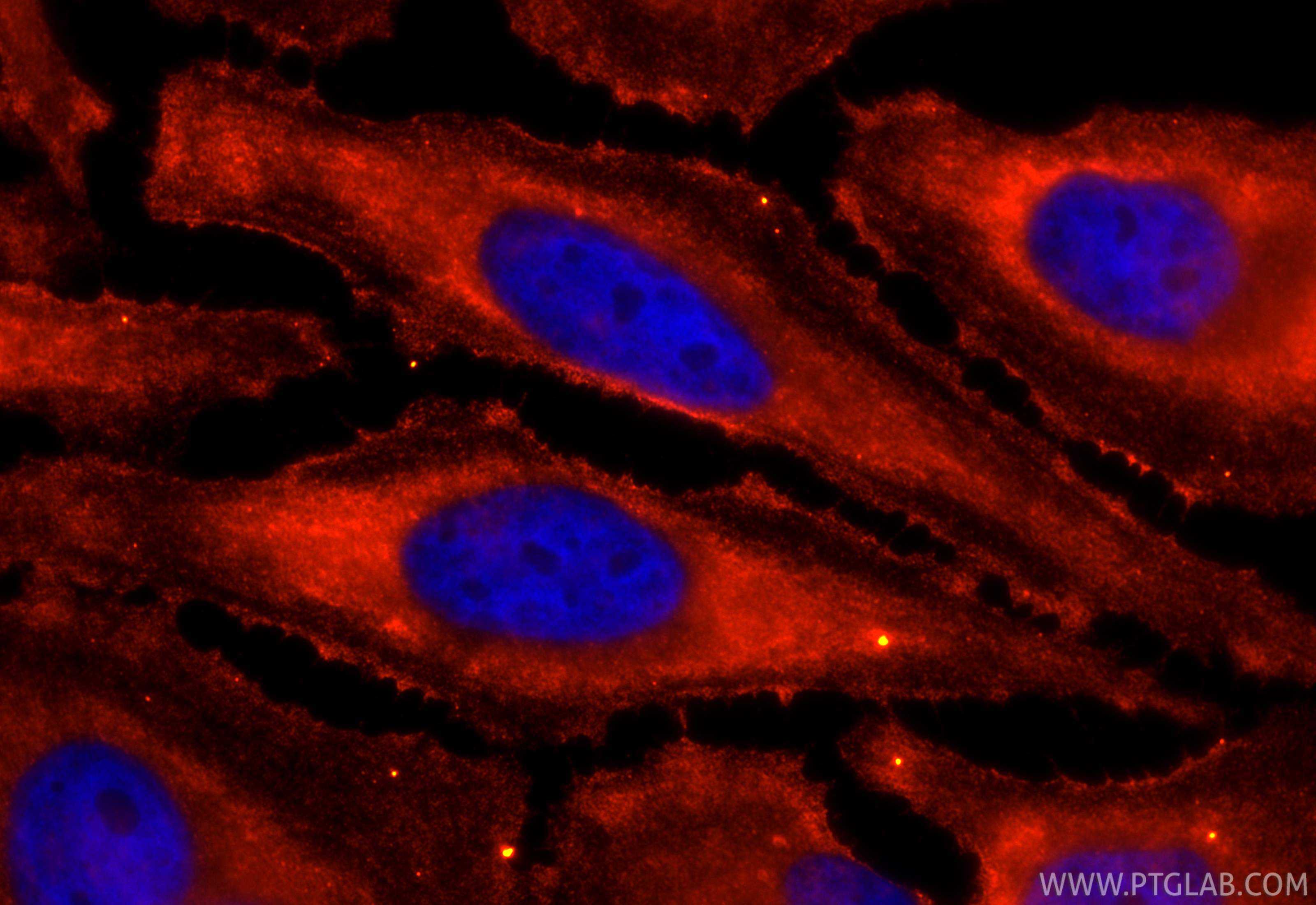 IF Staining of HeLa using CL594-66399
