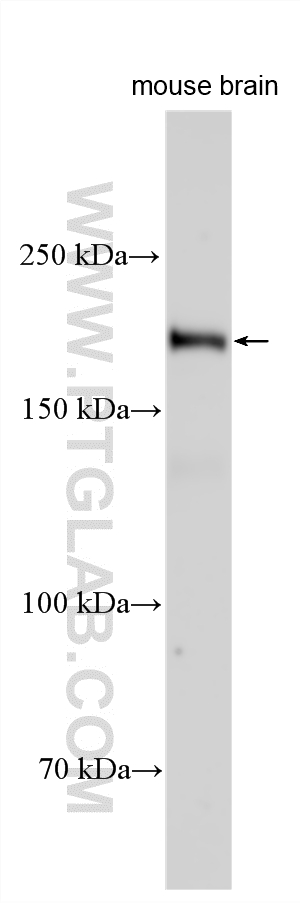 Various lysates were subjected to SDS PAGE followed by western blot with 33781-1-AP (Plexin C1 antibody) at dilution of 1:1000 incubated at room temperature for 1.5 hours. WB analysis using 33781-1-AP