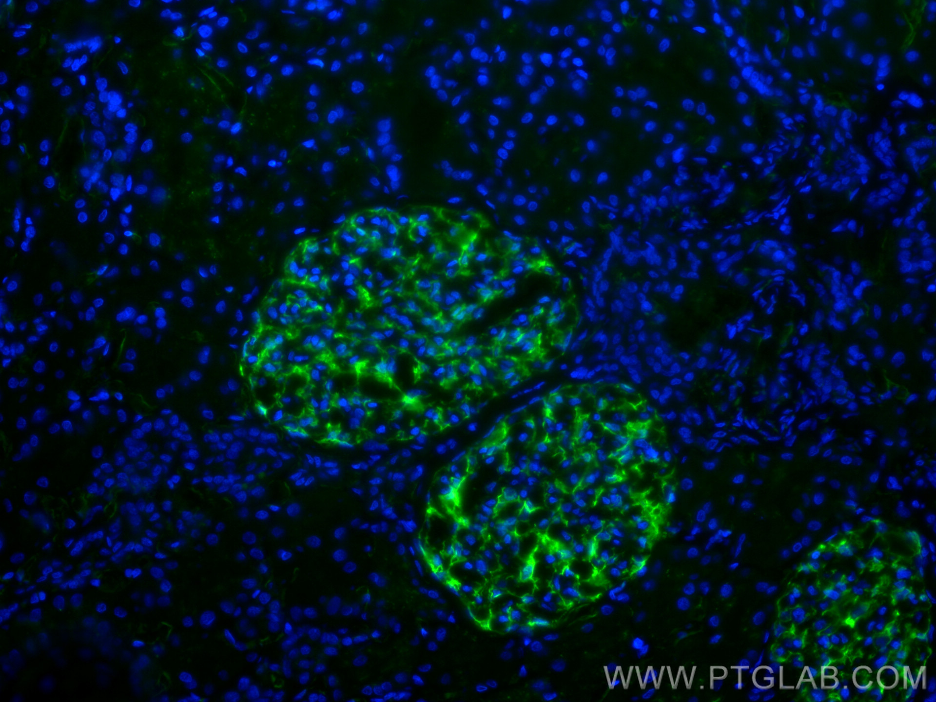 IF Staining of human kidney using 68250-1-Ig (same clone as 68250-1-PBS)