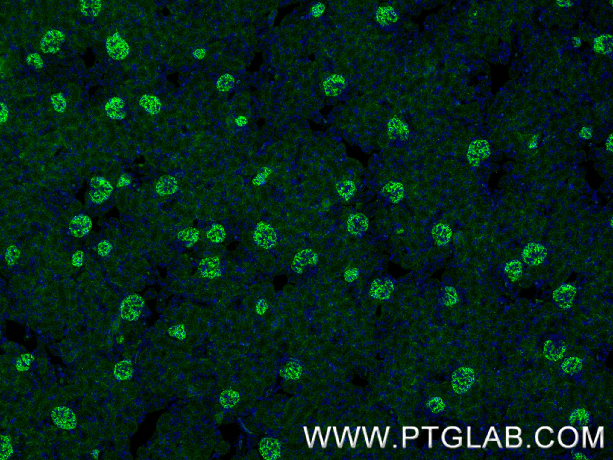 IF Staining of mouse kidney using 87582-2-RR (same clone as 87582-2-PBS) IF Staining of mouse kidney using 87582-2-RR (same clone as 87582-2-PBS)