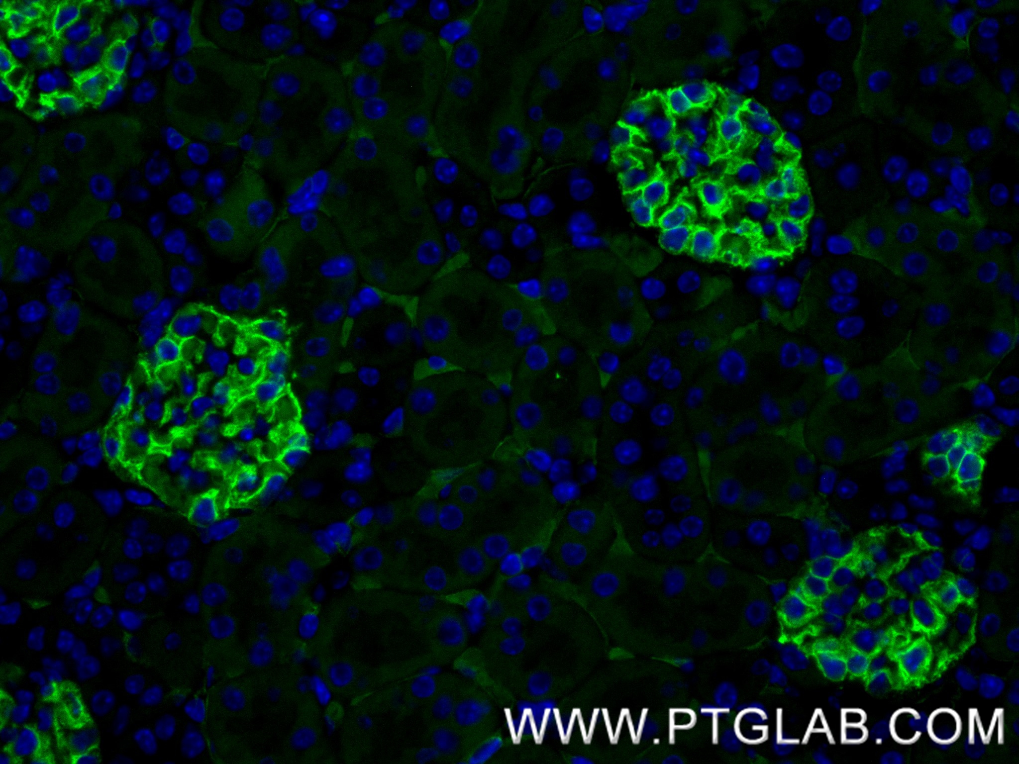 IF Staining of mouse kidney using 87582-2-RR (same clone as 87582-2-PBS) IF Staining of mouse kidney using 87582-2-RR (same clone as 87582-2-PBS)