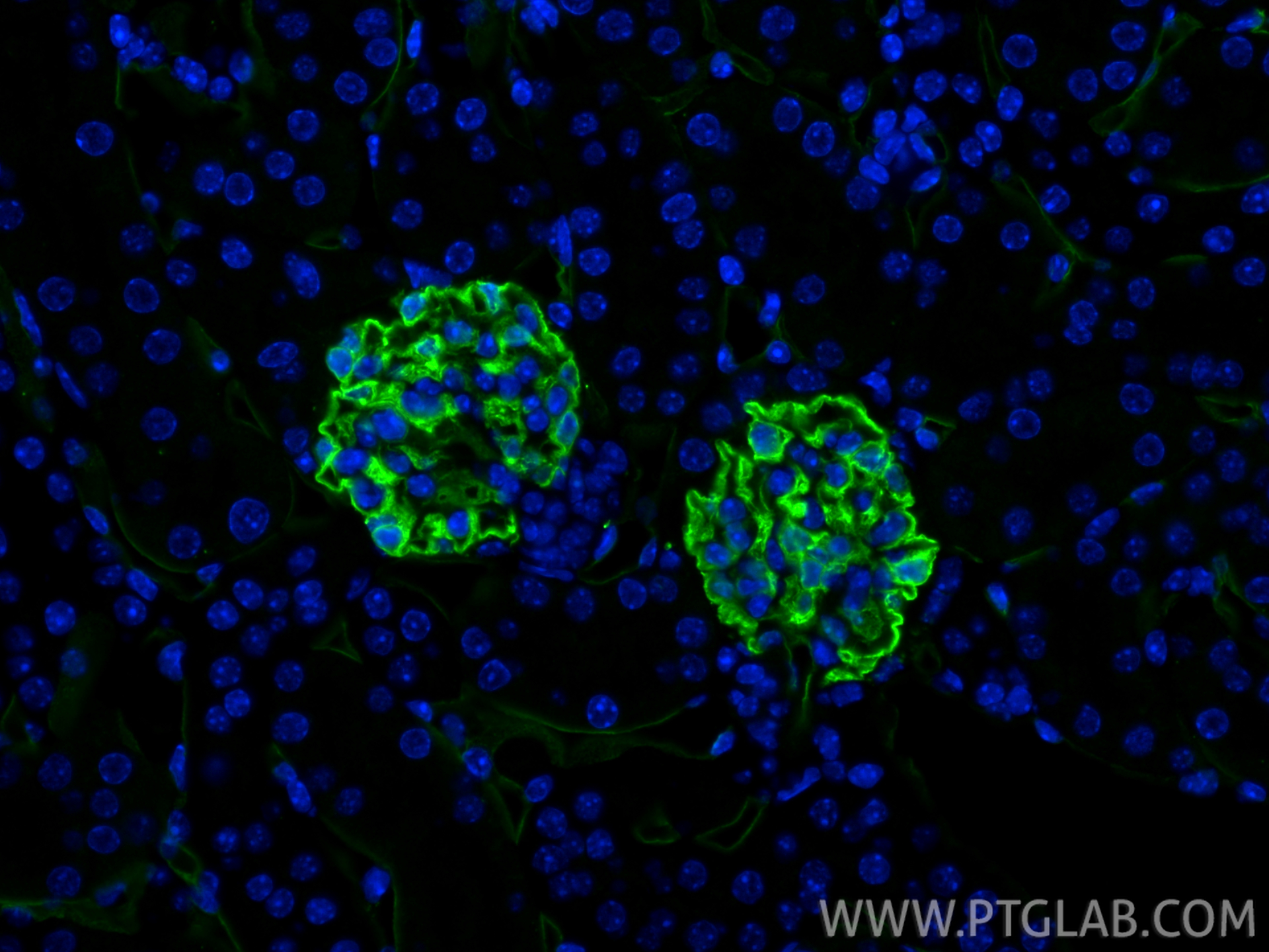 IF Staining of mouse kidney using 87582-2-RR IF Staining of mouse kidney using 87582-2-RR