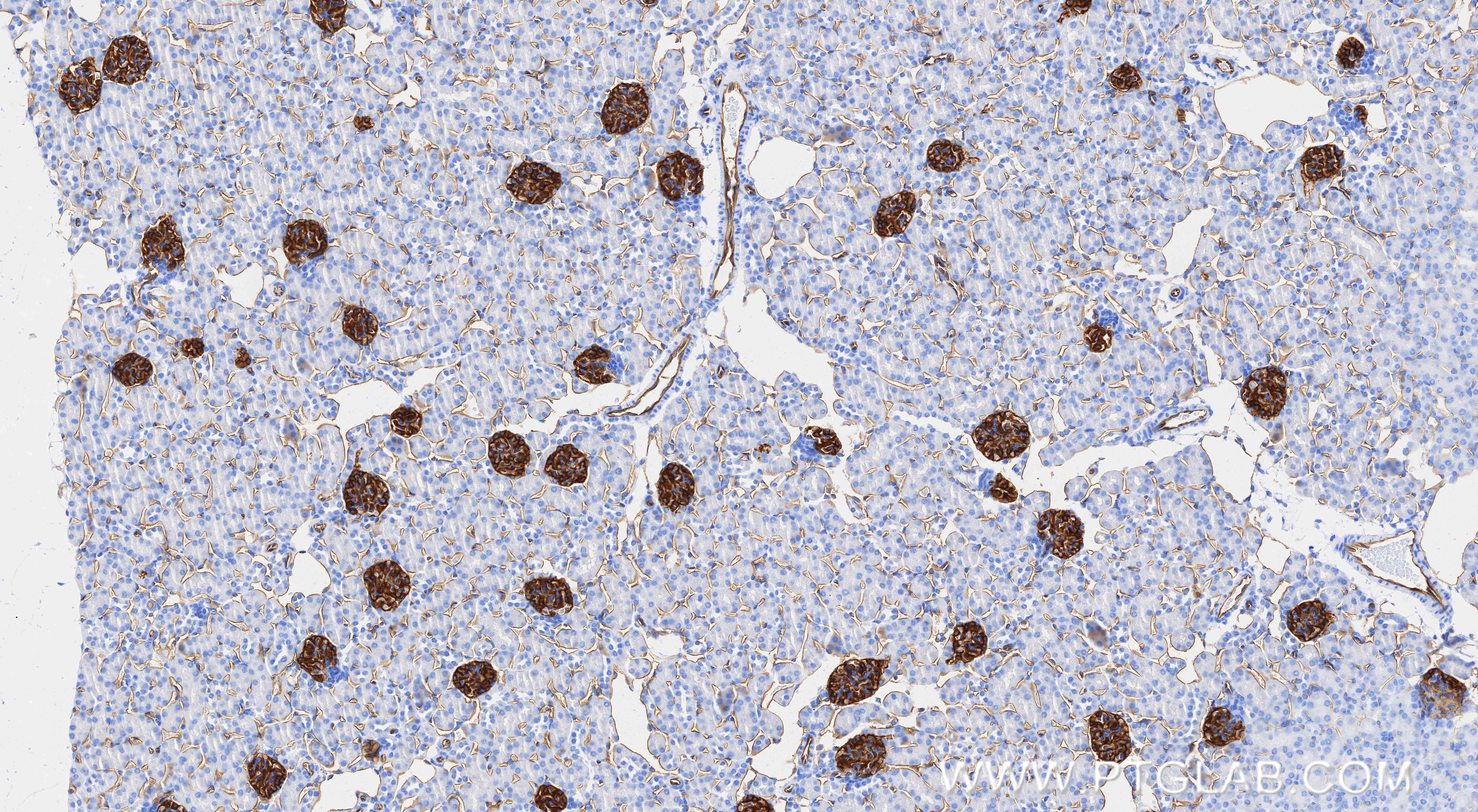 IHC staining of mouse kidney using 87582-2-RR (same clone as 87582-2-PBS) IHC staining of mouse kidney using 87582-2-RR (same clone as 87582-2-PBS)