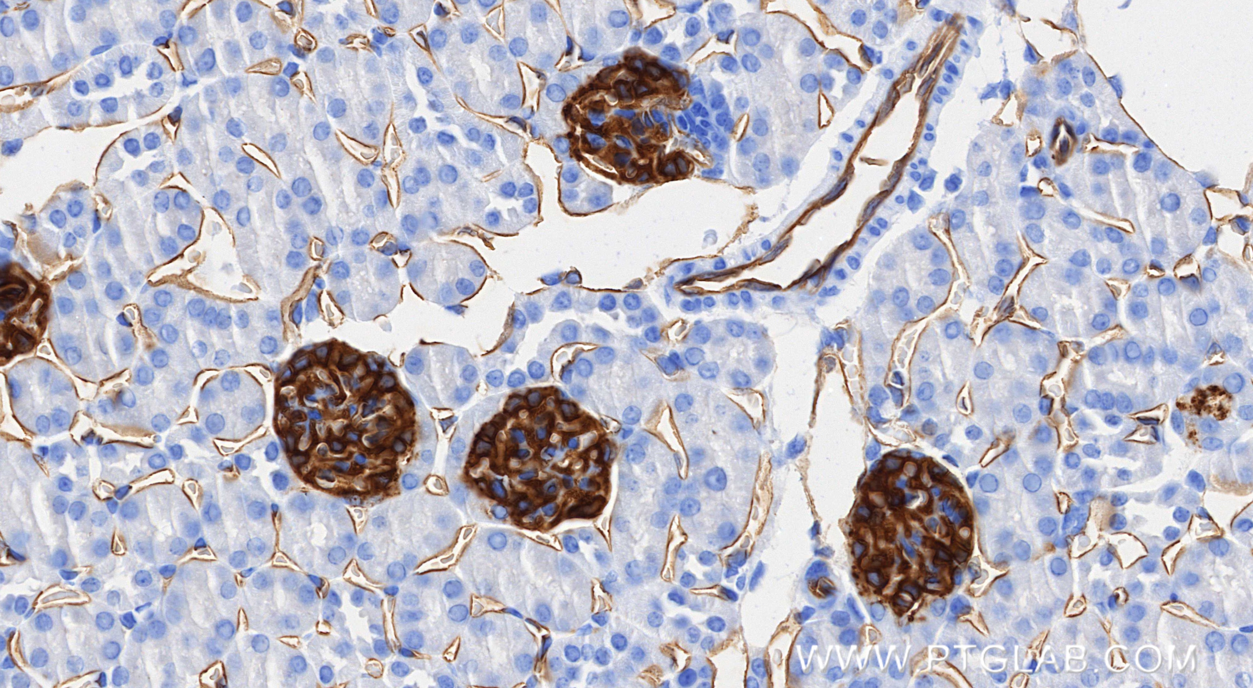 IHC staining of mouse kidney using 87582-2-RR (same clone as 87582-2-PBS) IHC staining of mouse kidney using 87582-2-RR (same clone as 87582-2-PBS)