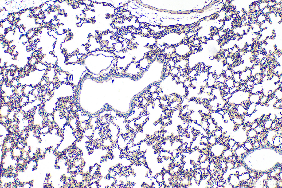 IHC staining of mouse lung using 33099-1-AP
