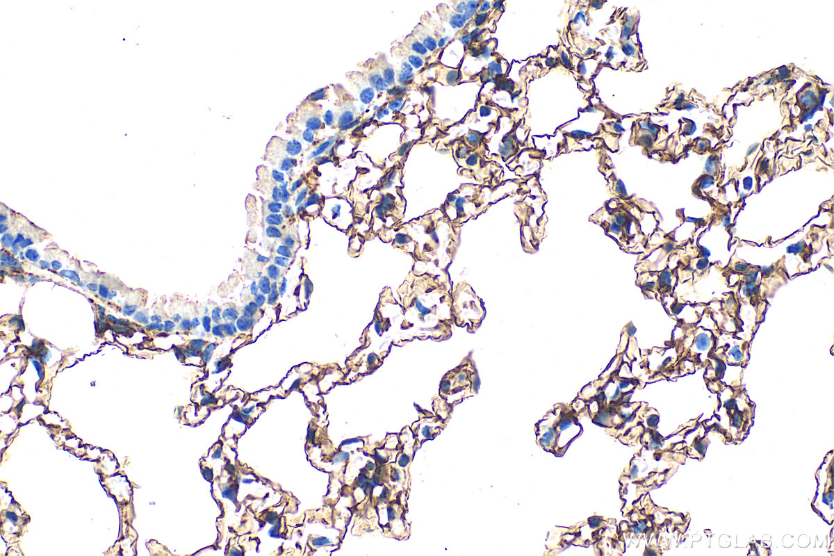 IHC staining of mouse lung using 33099-1-AP