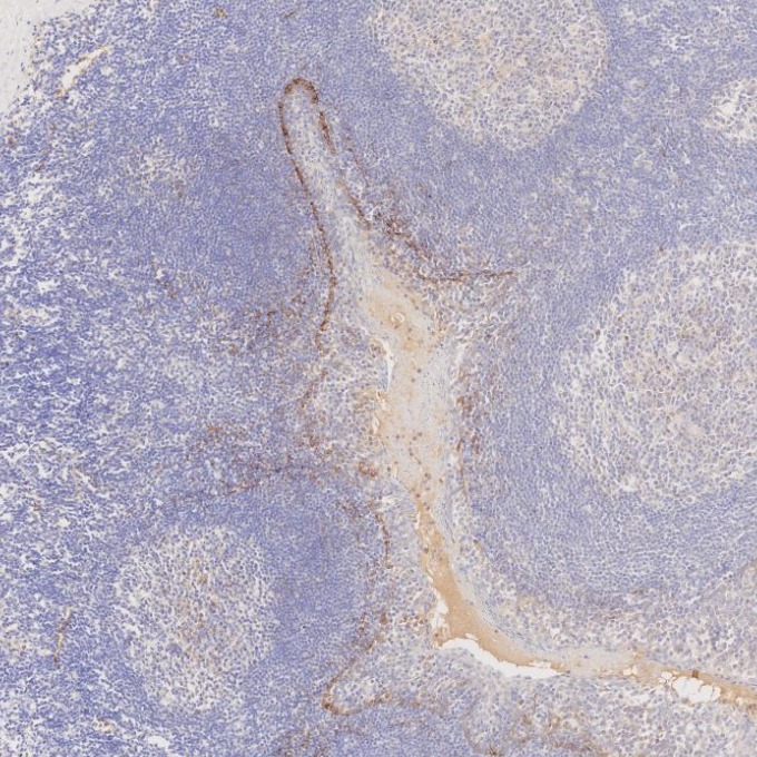 IHC staining of human tonsillitis using 67432-1-Ig (same clone as 67432-1-PBS)