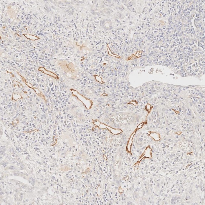 IHC staining of human liver using 67432-1-Ig (same clone as 67432-1-PBS)