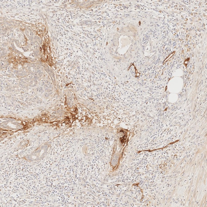 IHC staining of human pancreas using 67432-1-Ig (same clone as 67432-1-PBS)