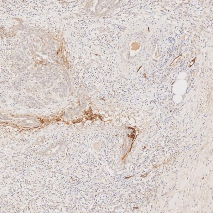 IHC staining of human pancreas using 67432-1-Ig (same clone as 67432-1-PBS)