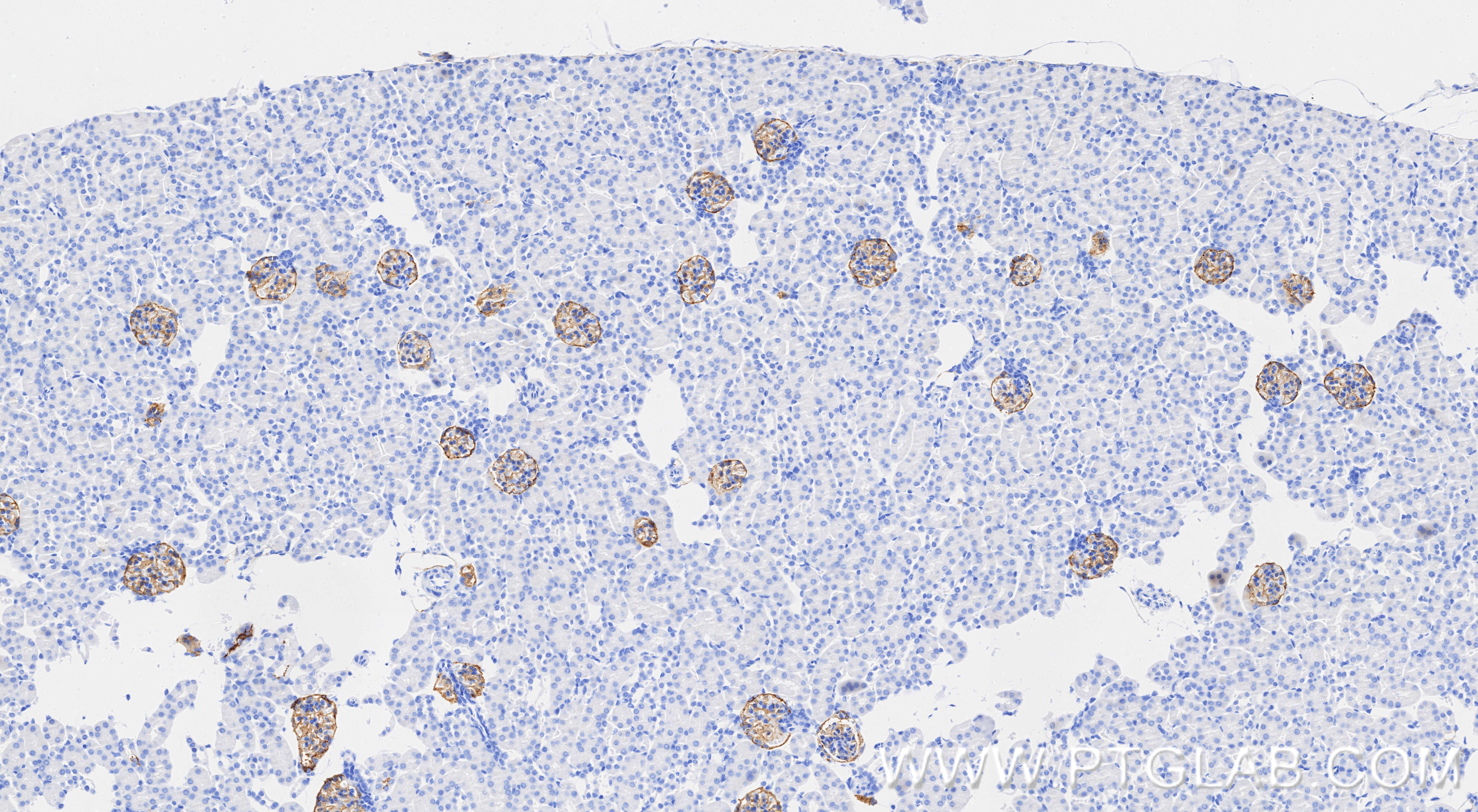 IHC staining of mouse kidney using 86107-1-RR IHC staining of mouse kidney using 86107-1-RR