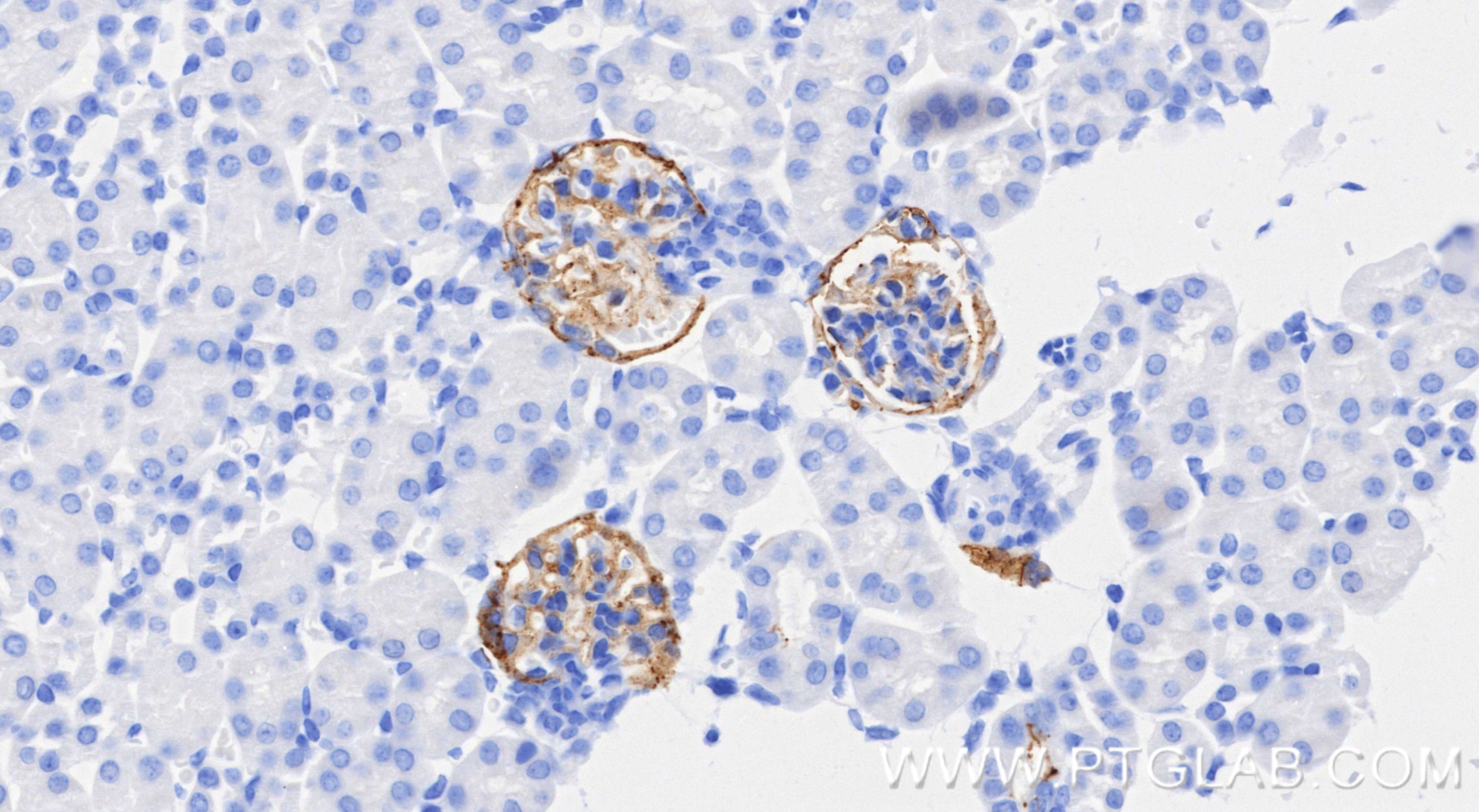IHC staining of mouse kidney using 86107-1-RR IHC staining of mouse kidney using 86107-1-RR