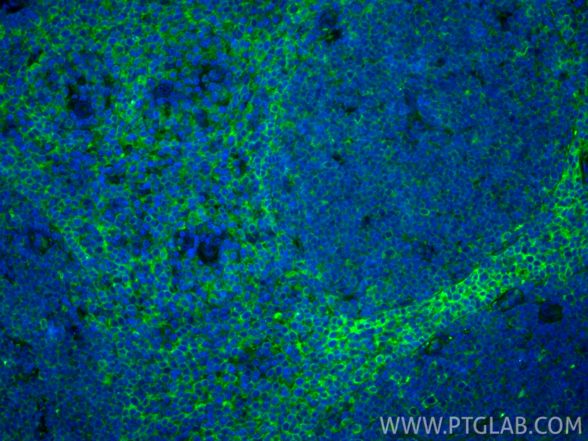 IF Staining of human tonsillitis using 86750-2-RR (same clone as 86750-2-PBS)