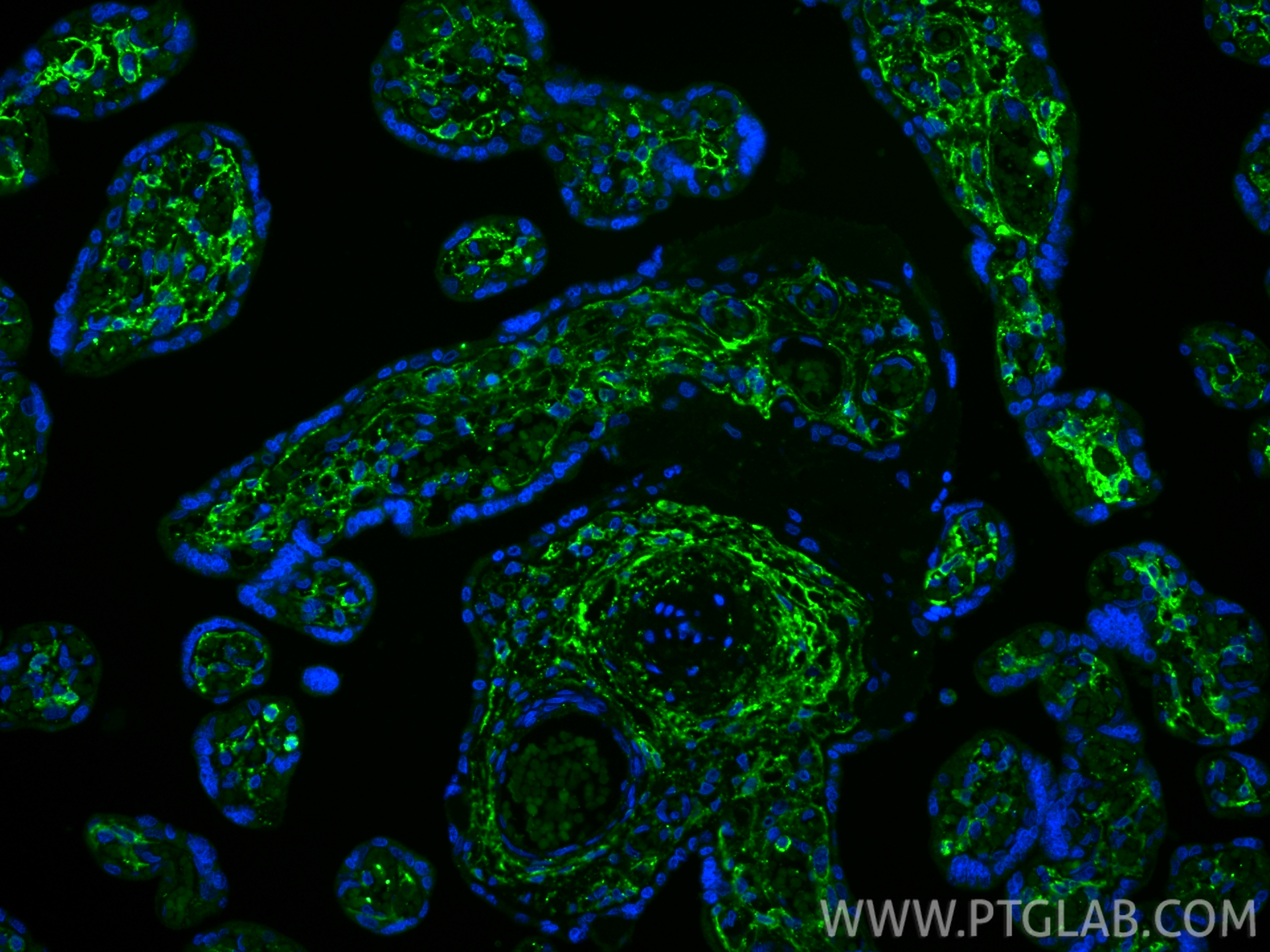 IF Staining of human placenta using 86750-2-RR (same clone as 86750-2-PBS)