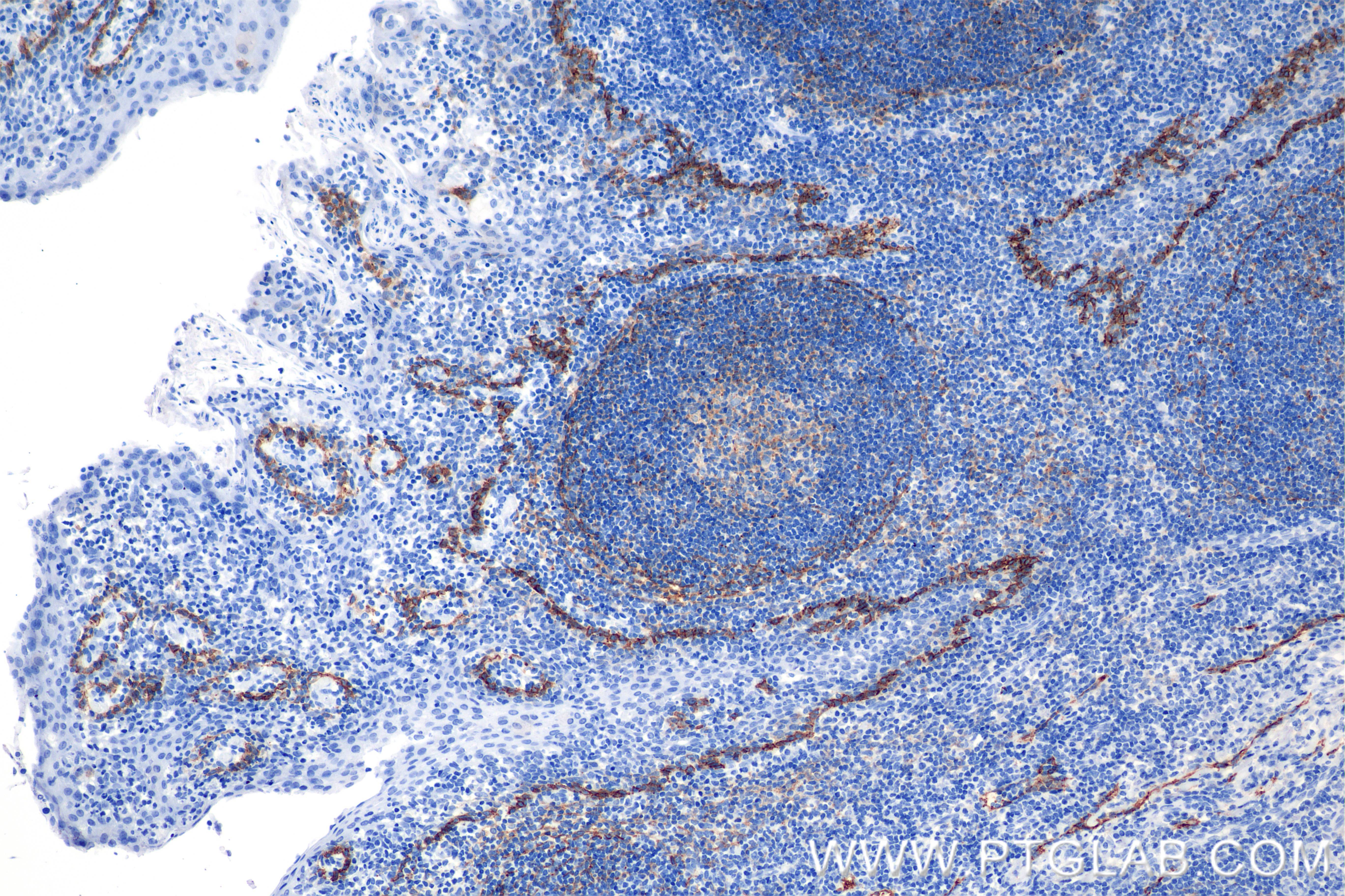 IHC staining of human tonsil using 86750-2-RR