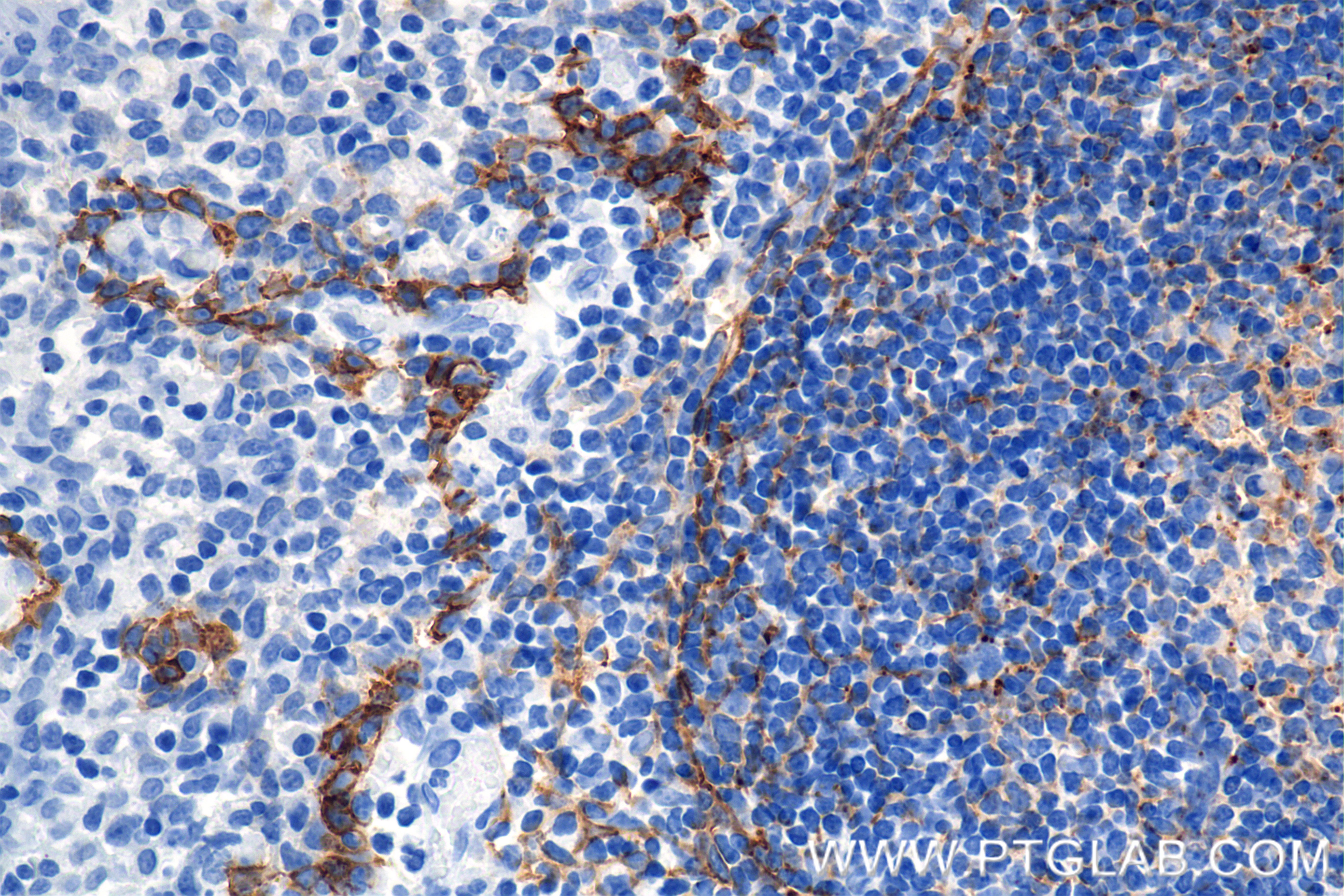 IHC staining of human tonsil using 86750-2-RR