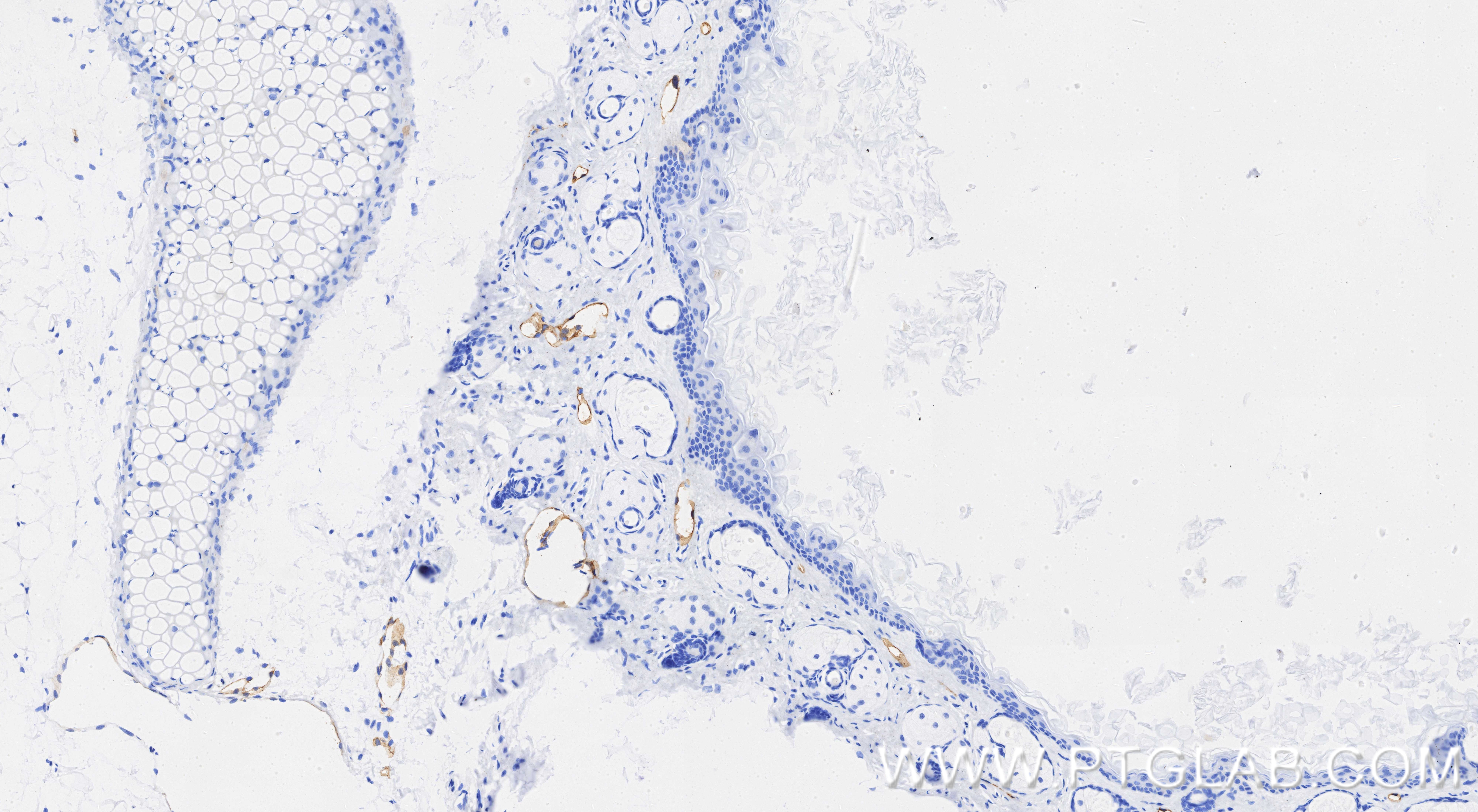 IHC staining of mouse skin using 98492-3-RR (same clone as 98492-3-PBS) IHC staining of mouse skin using 98492-3-RR (same clone as 98492-3-PBS)
