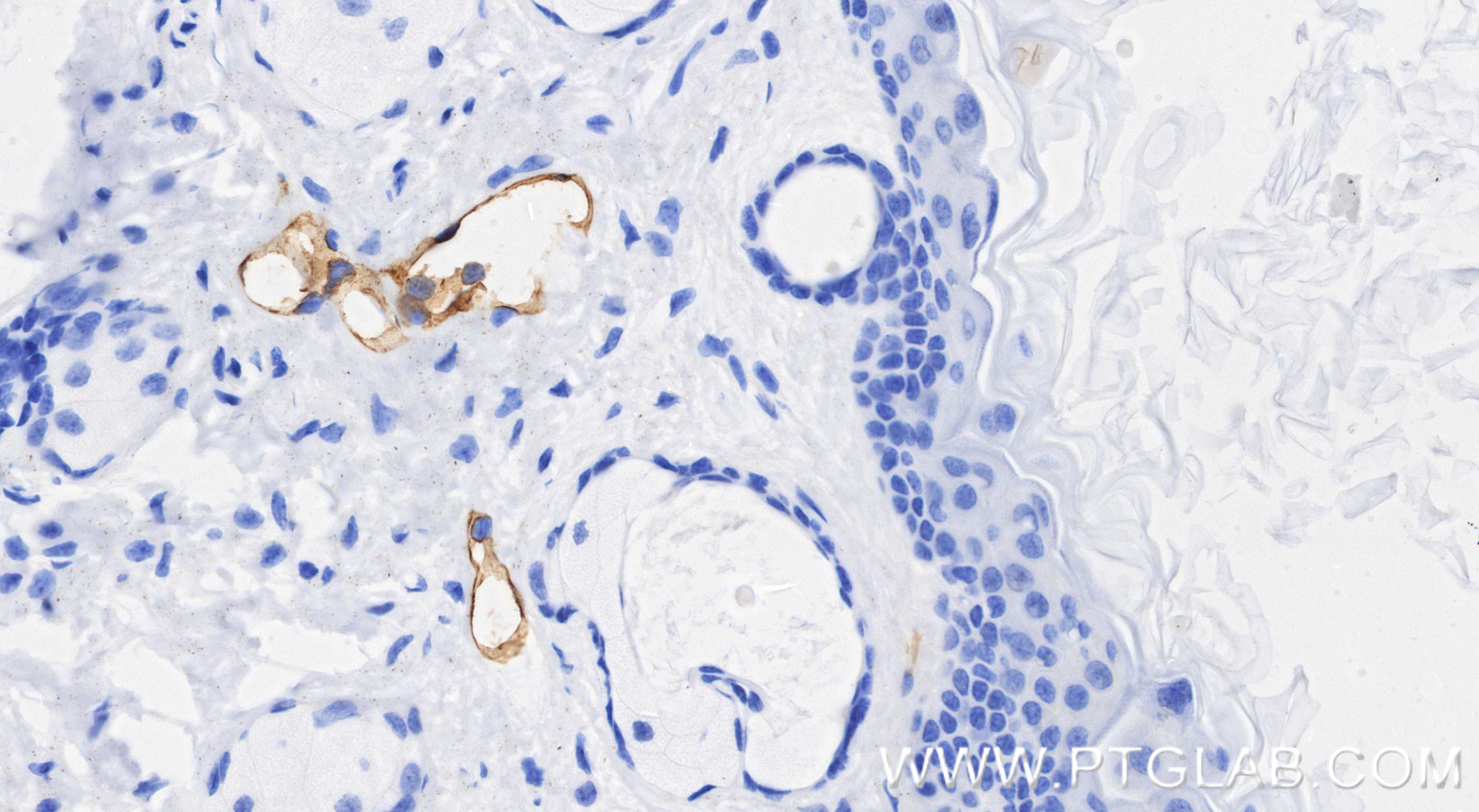 IHC staining of mouse skin using 98492-3-RR (same clone as 98492-3-PBS) IHC staining of mouse skin using 98492-3-RR (same clone as 98492-3-PBS)