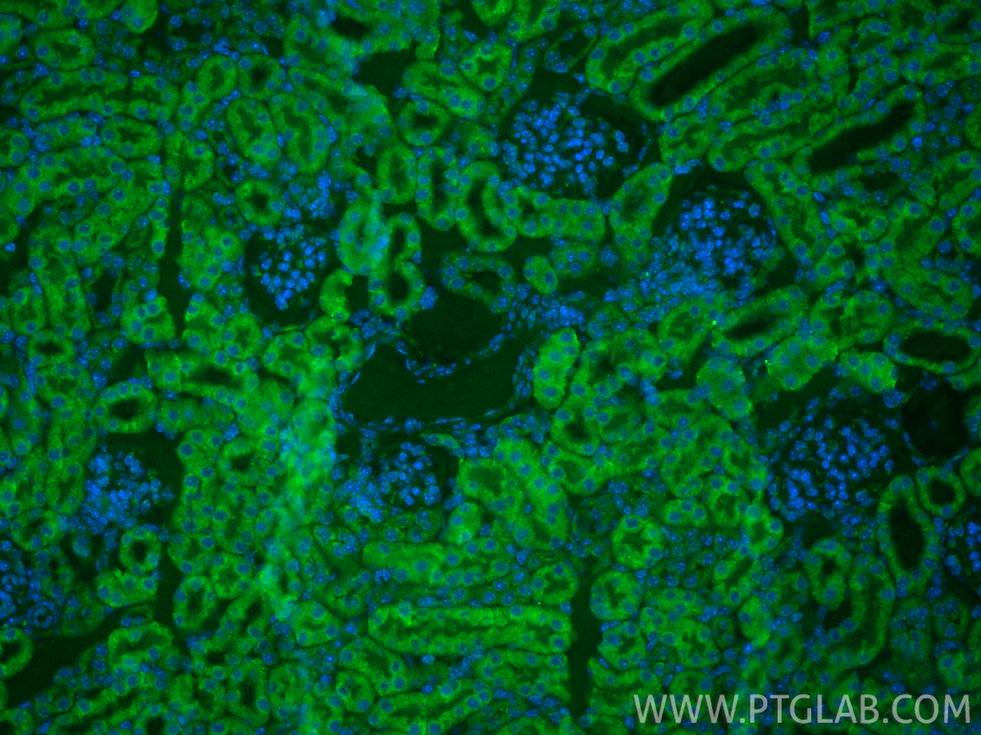 IF Staining of mouse kidney using CL488-86750-2