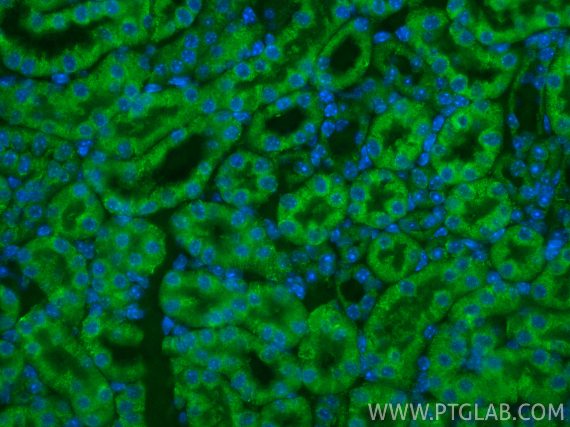 IF Staining of mouse kidney using CL488-86750-2 IF Staining of mouse kidney using CL488-86750-2