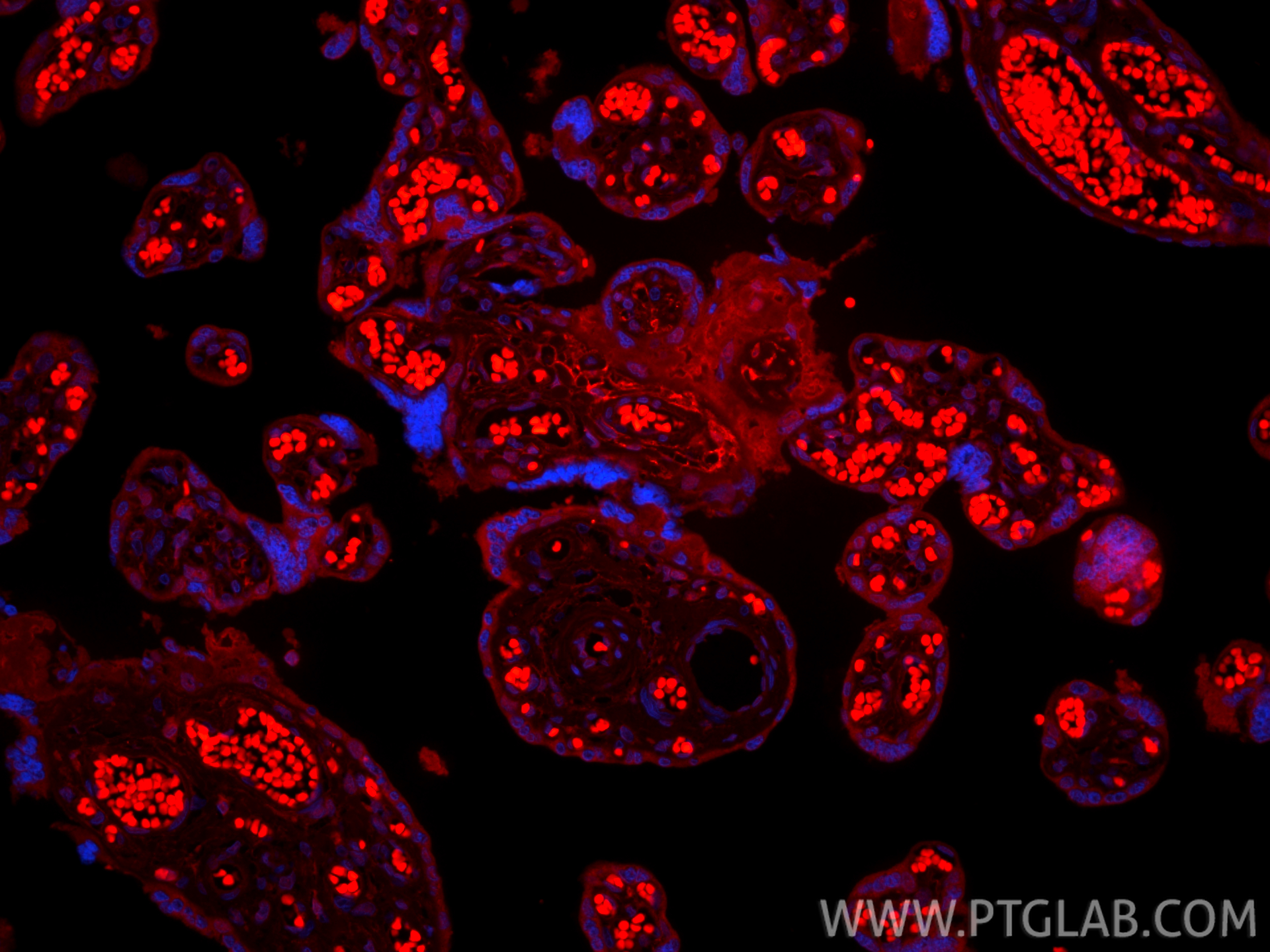 IF Staining of human placenta using CL594-86750-2 IF Staining of human placenta using CL594-86750-2