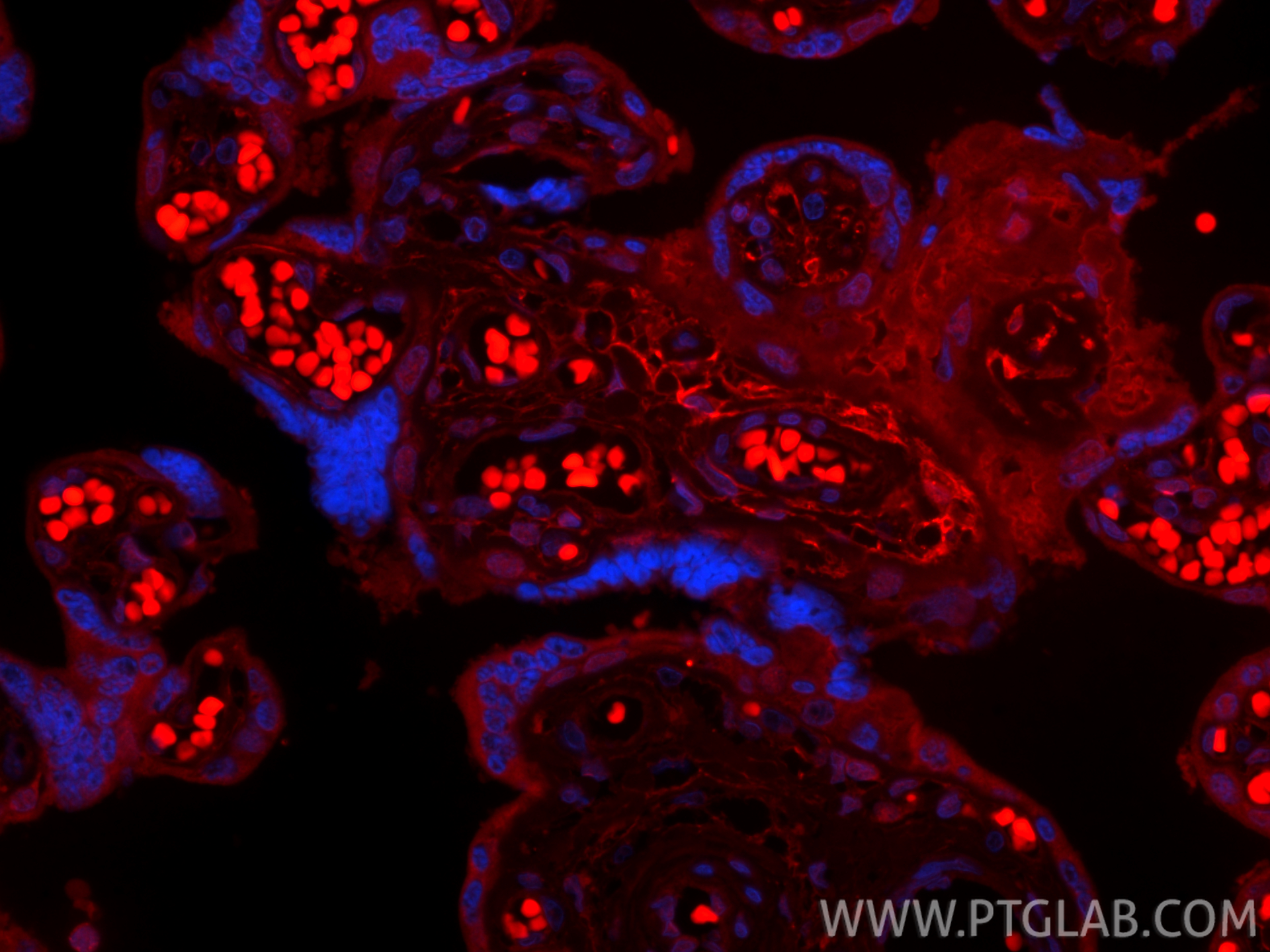 IF Staining of human placenta using CL594-86750-2 IF Staining of human placenta using CL594-86750-2