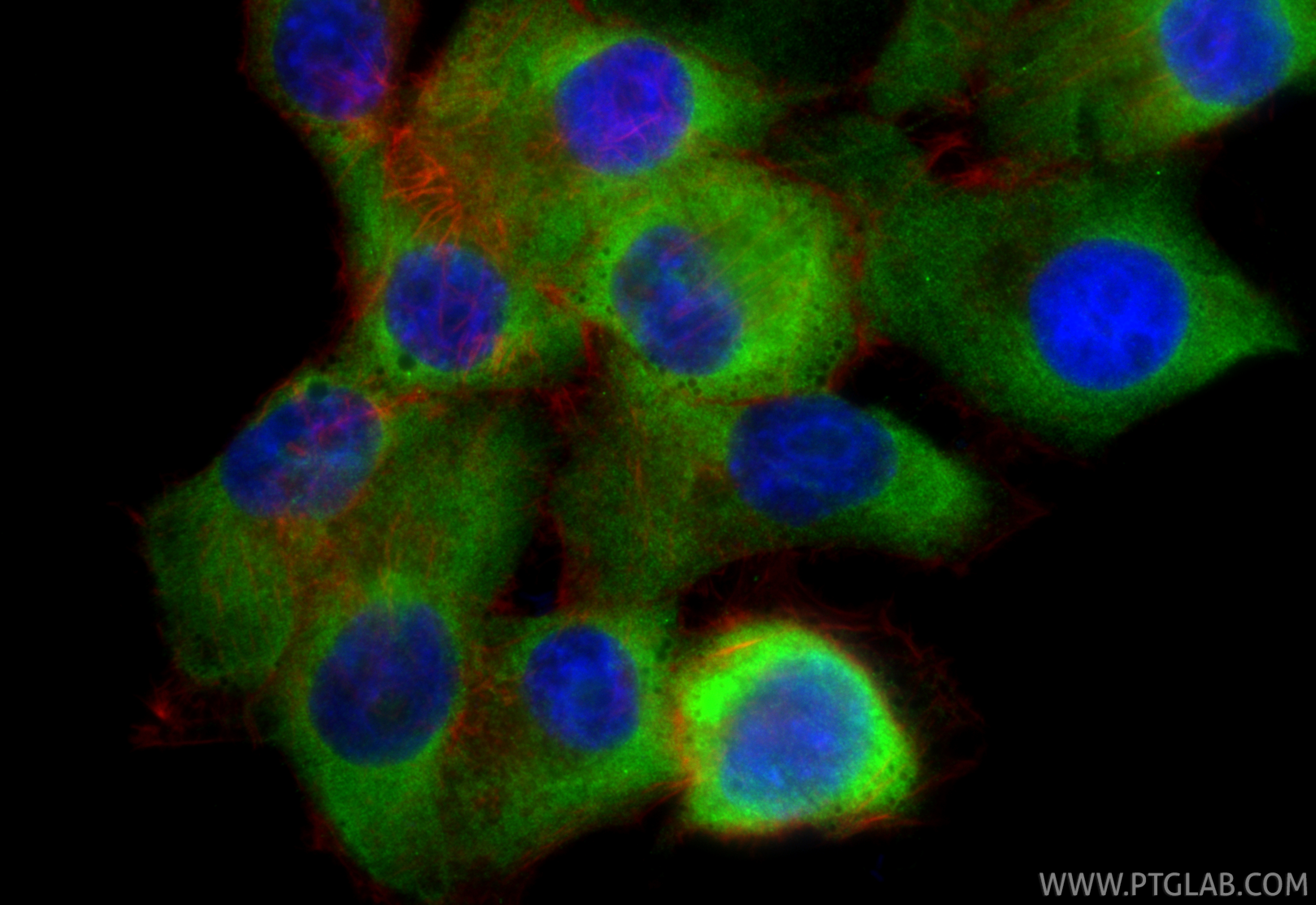 IF Staining of PANC-1 using 22263-1-AP IF Staining of PANC-1 using 22263-1-AP