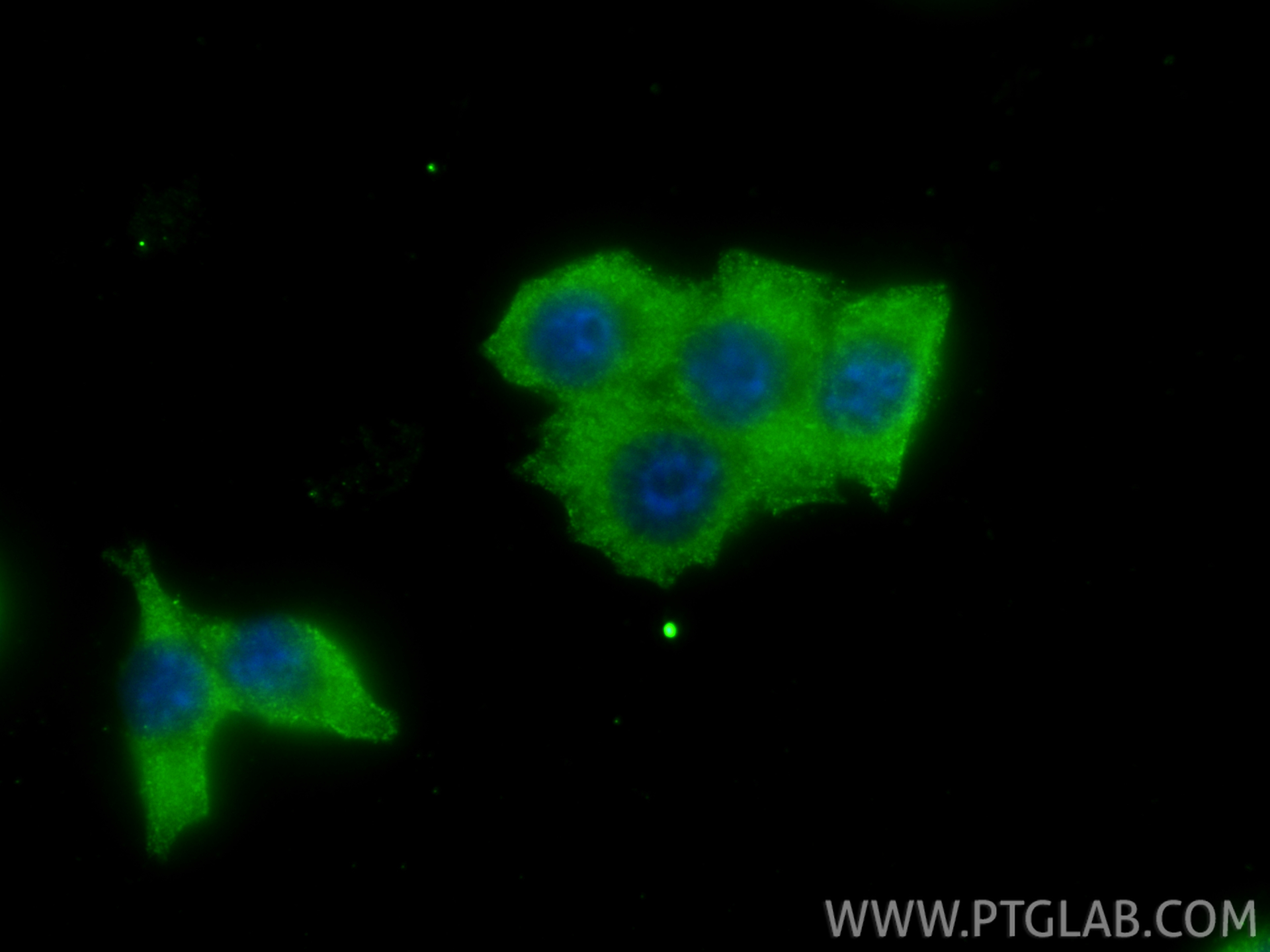 IF Staining of 4T1 using 22263-1-AP IF Staining of 4T1 using 22263-1-AP