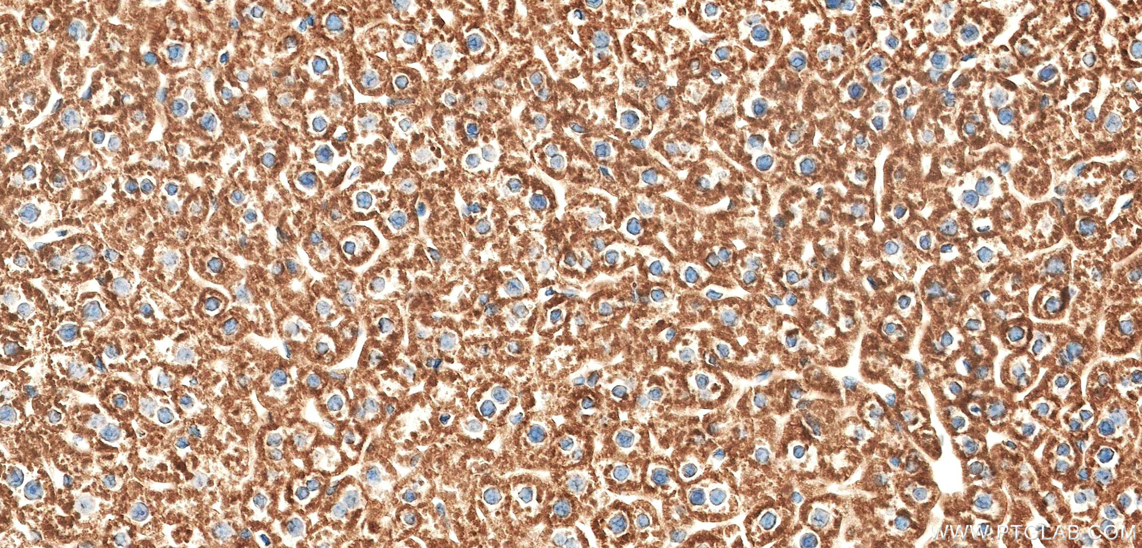 IHC staining of mouse liver using 86577-1-RR (same clone as 86577-1-PBS) IHC staining of mouse liver using 86577-1-RR (same clone as 86577-1-PBS)