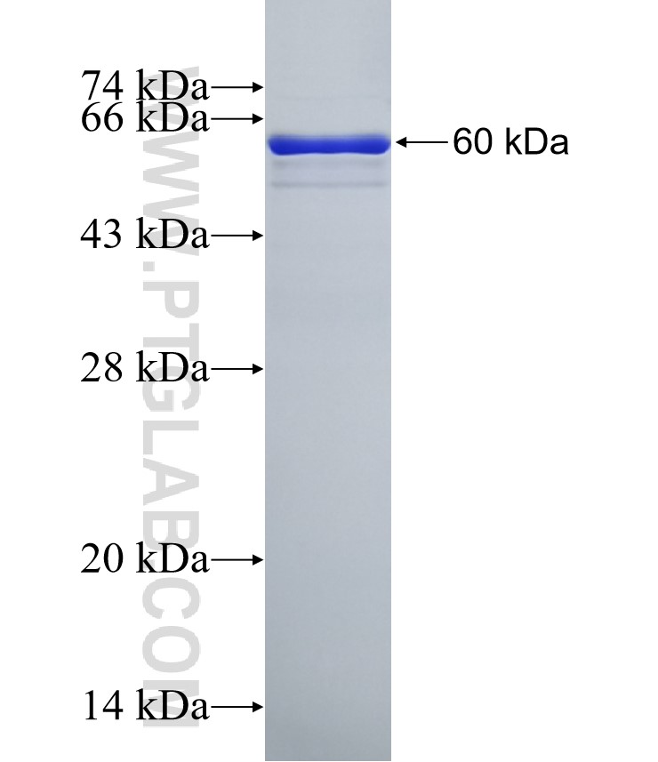 Porin fusion protein Ag1144 SDS-PAGE