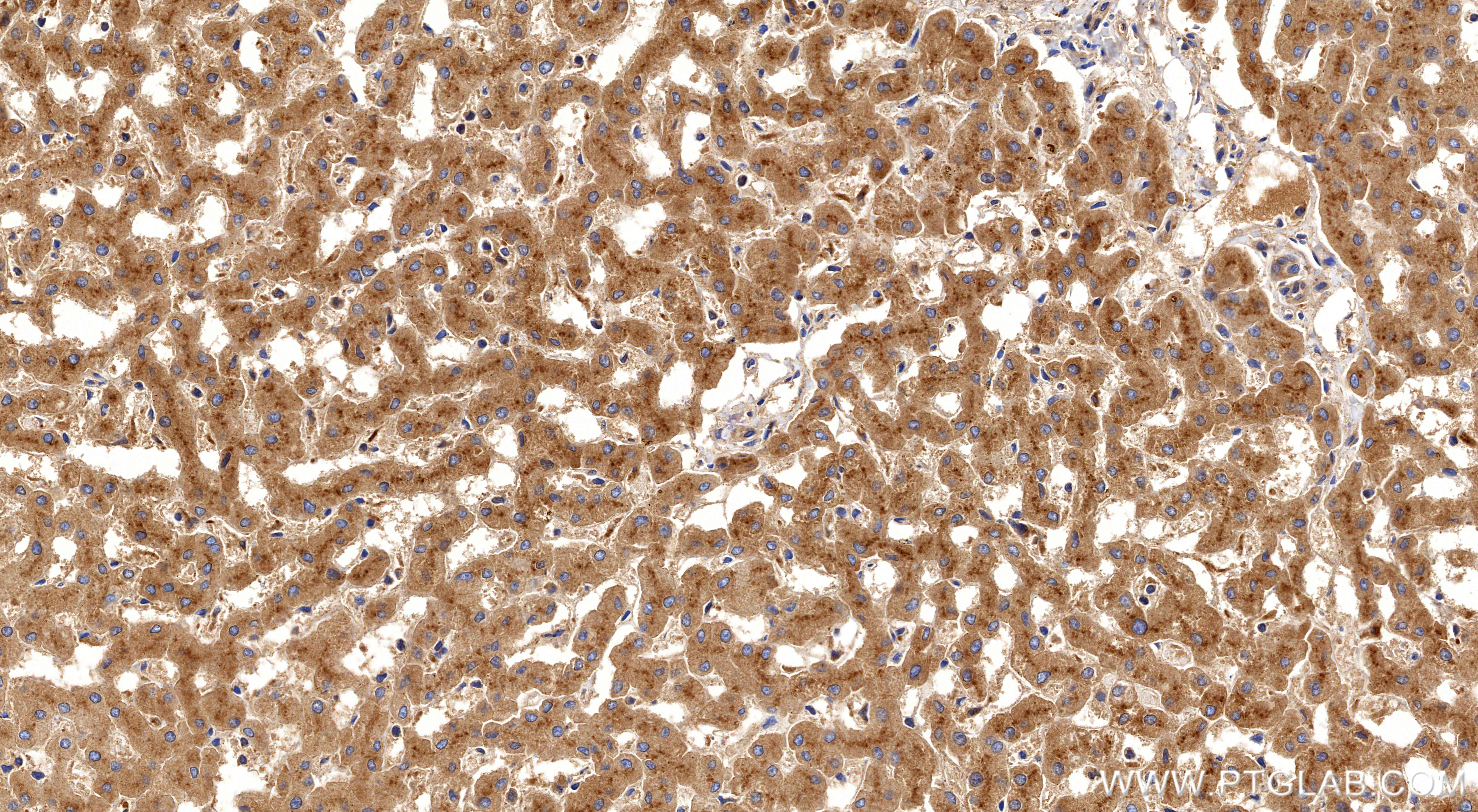 IHC staining of human liver using 86273-1-RR
