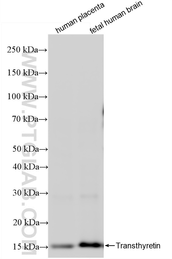 WB analysis using 86273-1-RR (same clone as 86273-1-PBS)