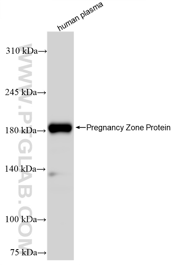 WB analysis of human plasma using 84605-4-RR