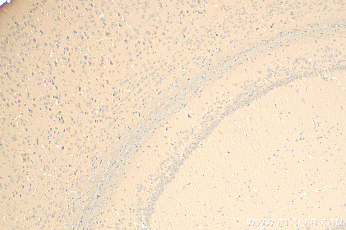 IHC staining of mouse brain using 83618-3-RR