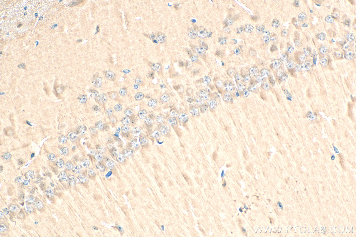 IHC staining of mouse brain using 83618-3-RR