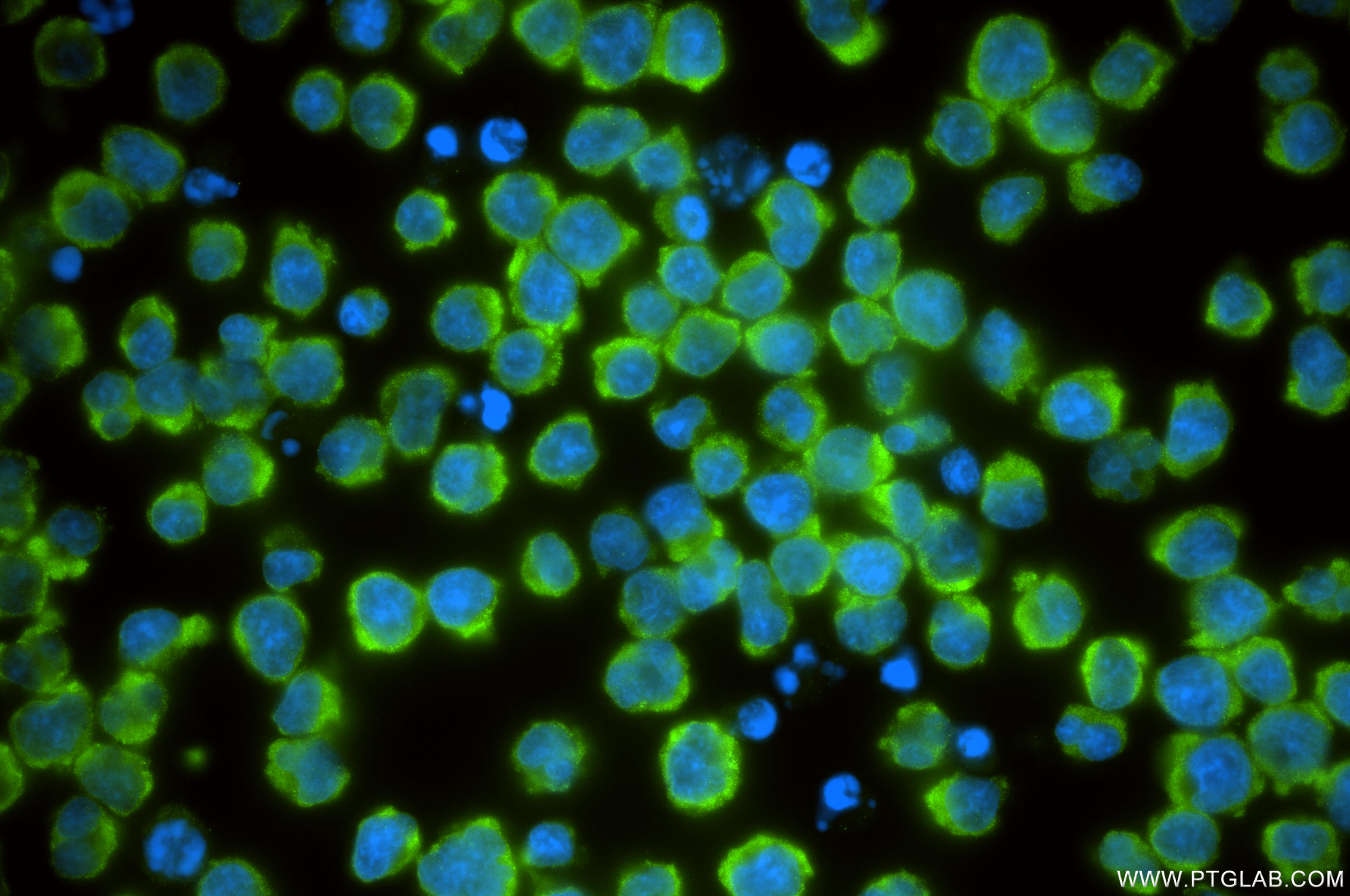 IF Staining of Jurkat using 83618-5-RR
