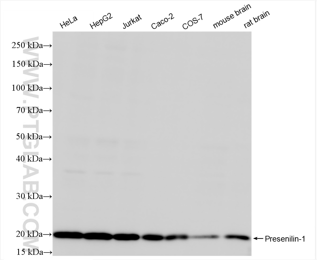 WB analysis using 83618-5-RR