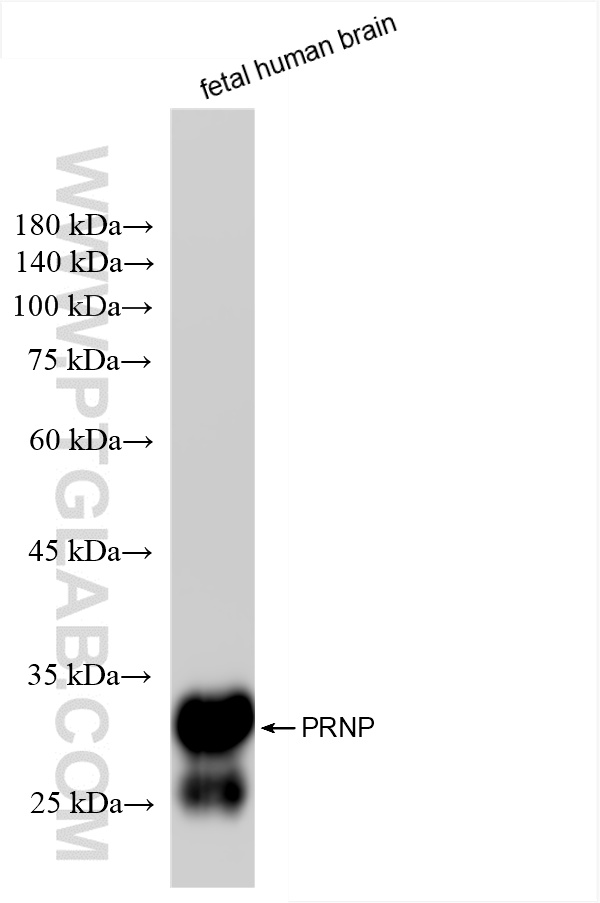 WB analysis of fetal human brain using 85611-4-RR (same clone as 85611-4-PBS)