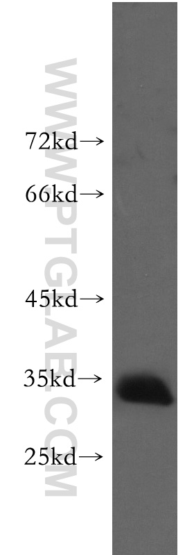 WB analysis of human skeletal muscle using 51026-2-AP