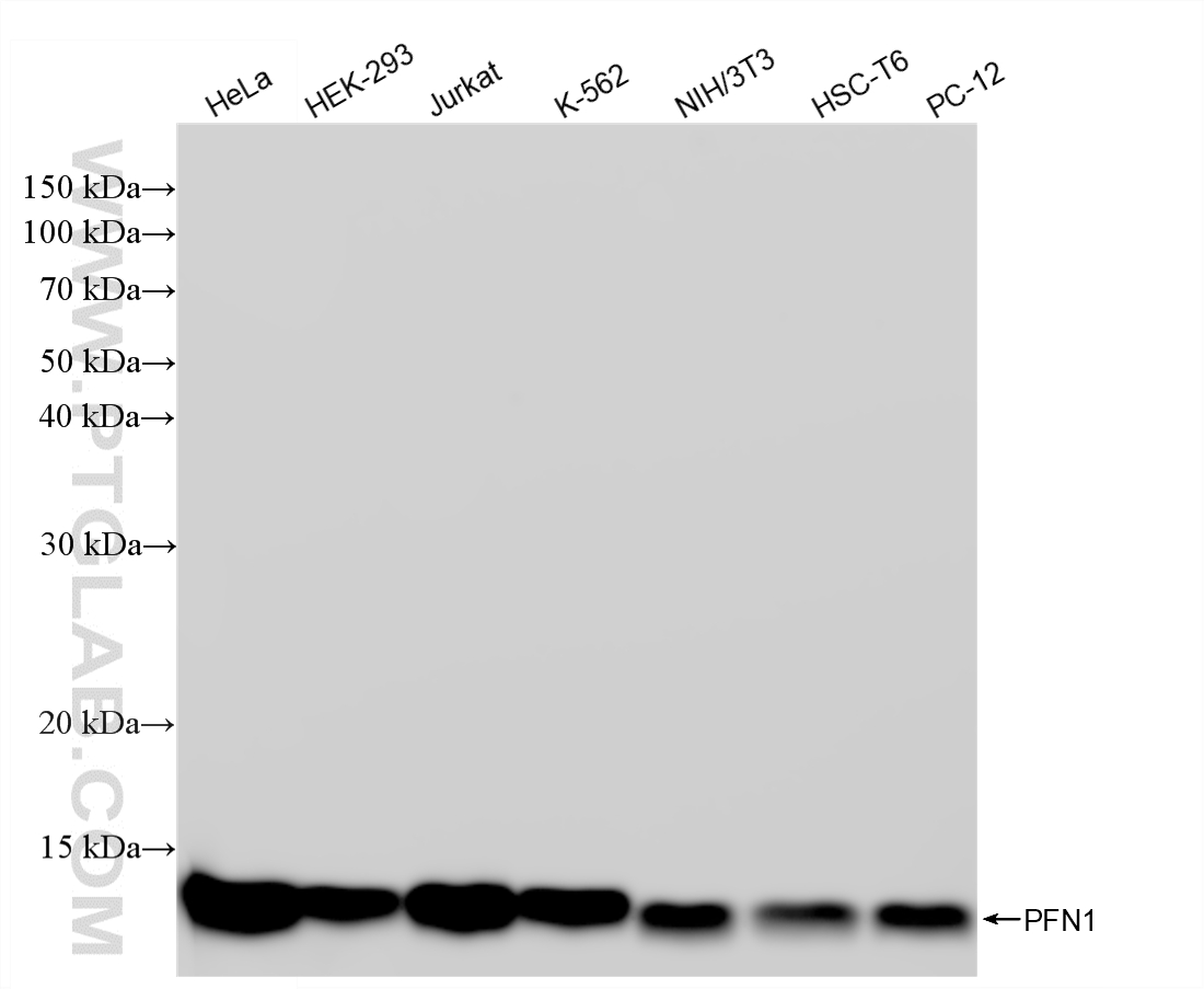 WB analysis using 88038-1-RR WB analysis using 88038-1-RR