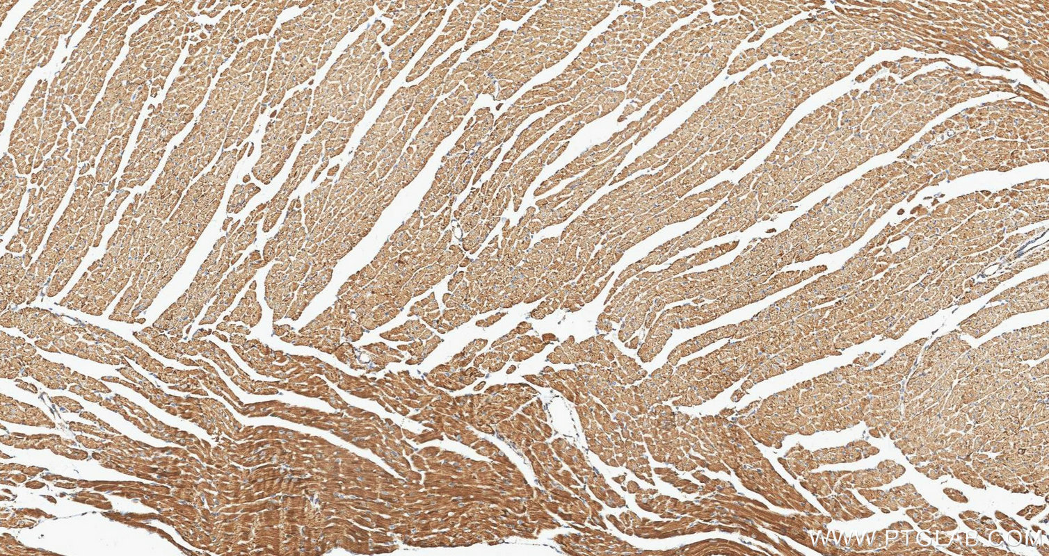 IHC staining of mouse heart using 88442-1-RR IHC staining of mouse heart using 88442-1-RR
