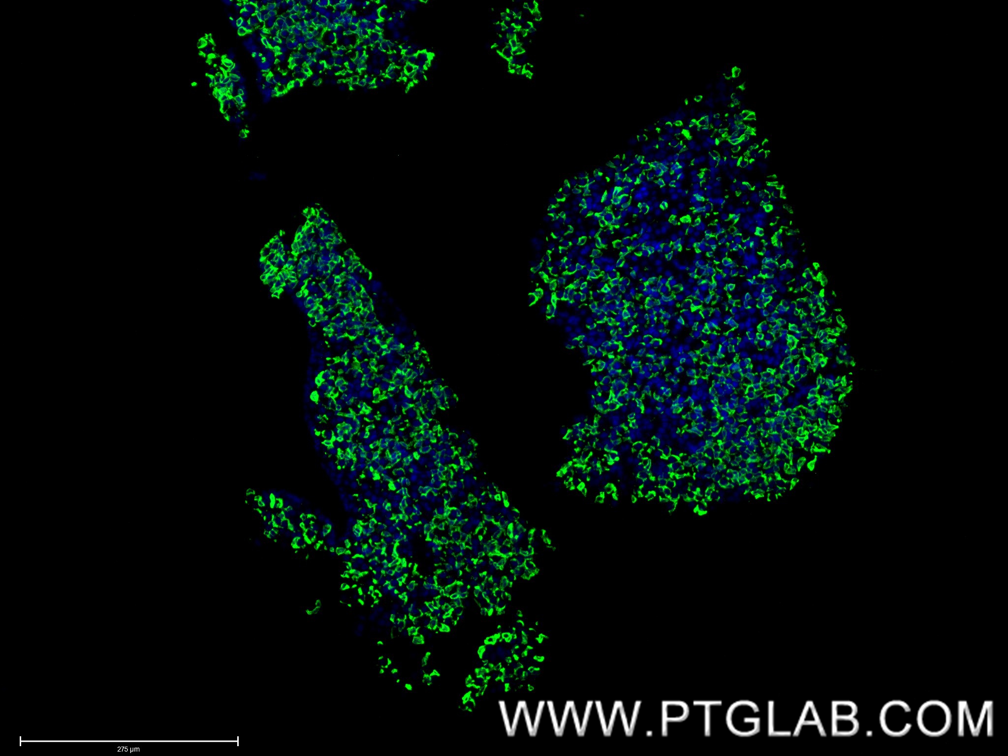 IF Staining of mouse pituitary gland using 85765-3-RR