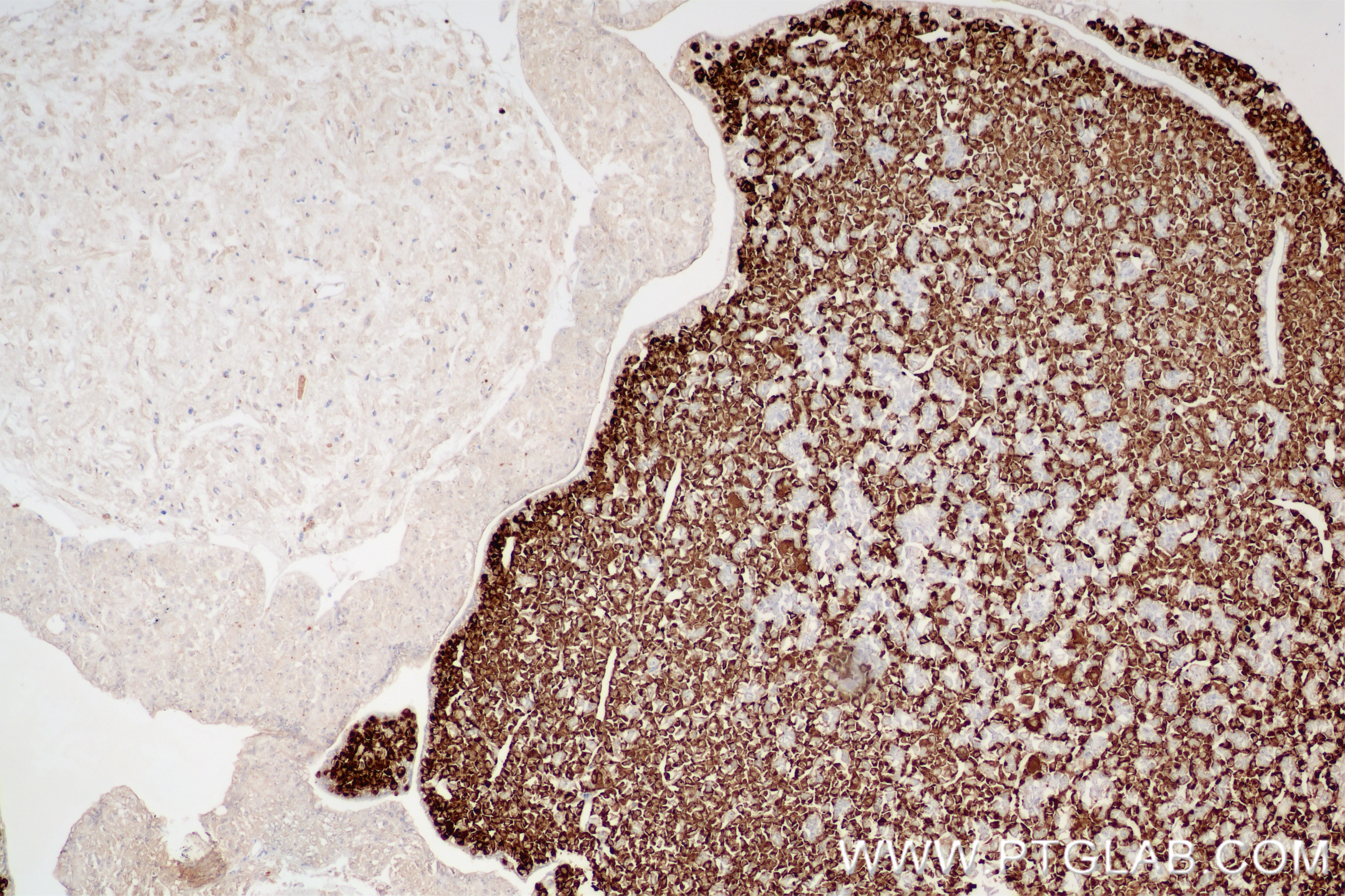 IHC staining of mouse pituitary gland using 85765-3-RR (same clone as 85765-3-PBS)