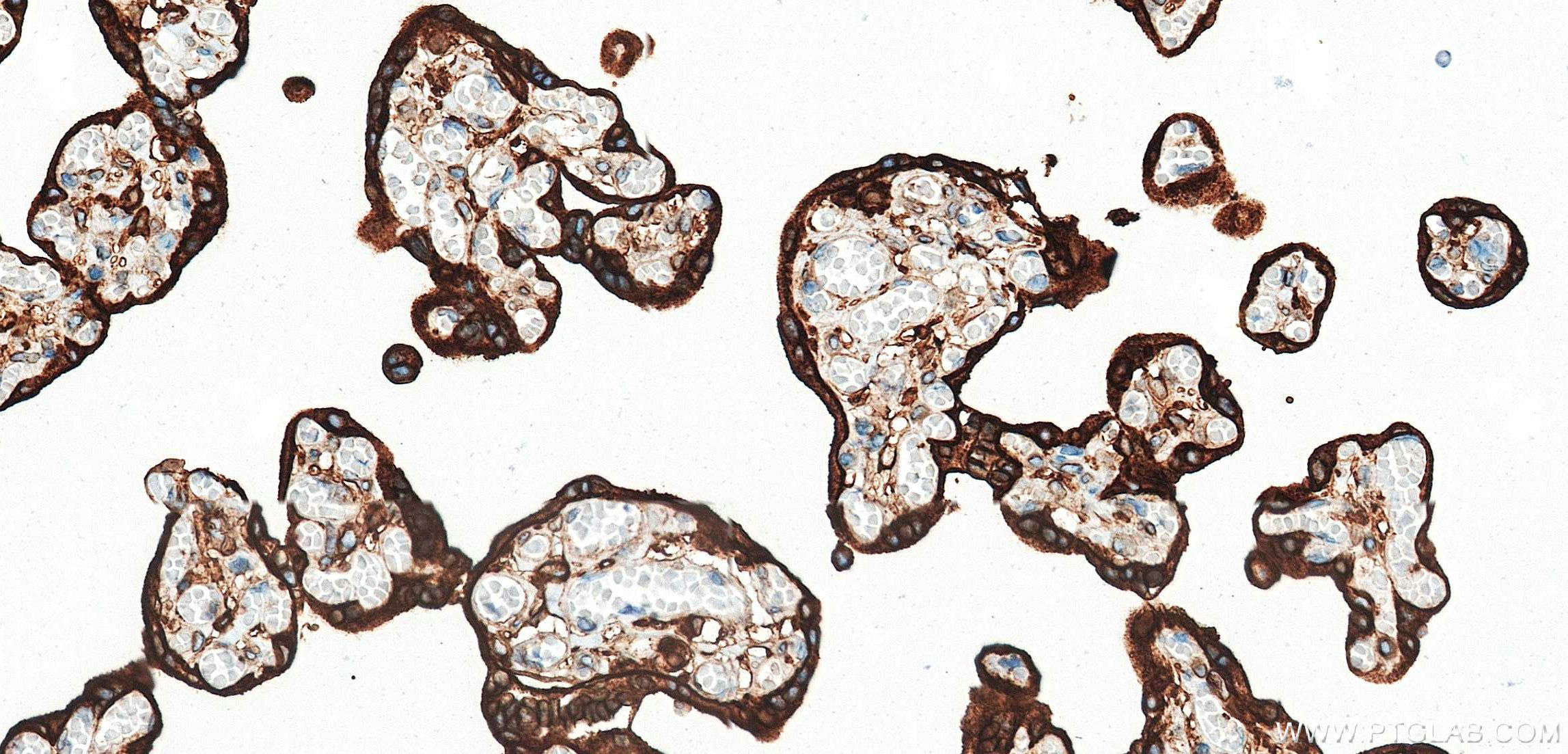 IHC staining of human placenta using 85765-3-RR (same clone as 85765-3-PBS) IHC staining of human placenta using 85765-3-RR (same clone as 85765-3-PBS)