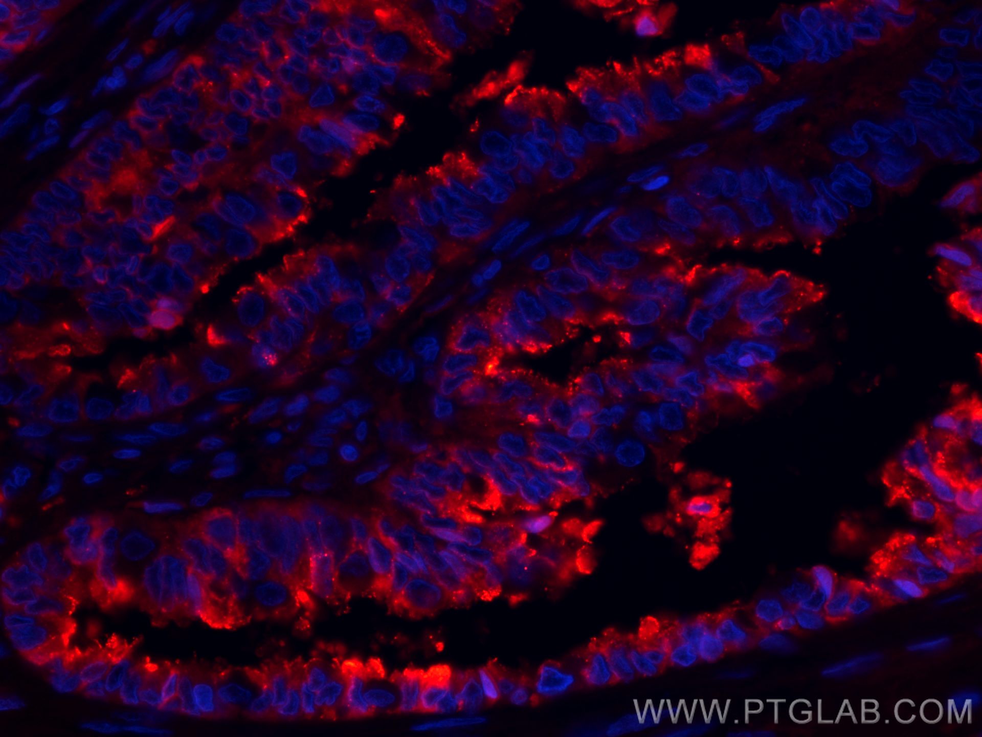 Protein C inhibitor