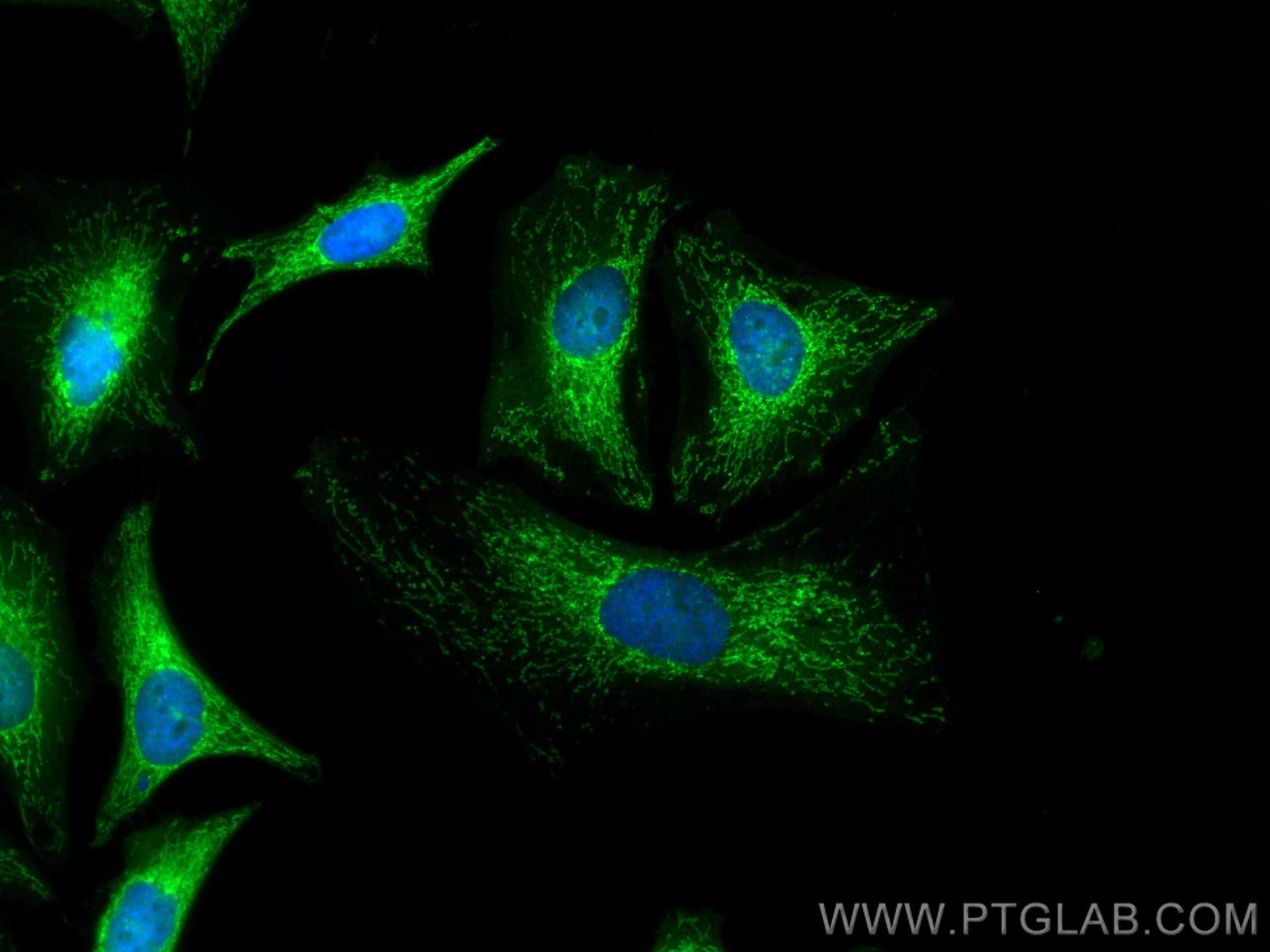 IF Staining of HeLa using 67599-1-Ig