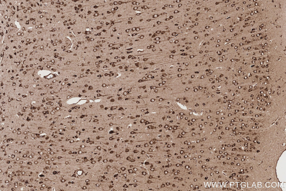 IHC staining of rat brain using 12645-1-AP IHC staining of rat brain using 12645-1-AP