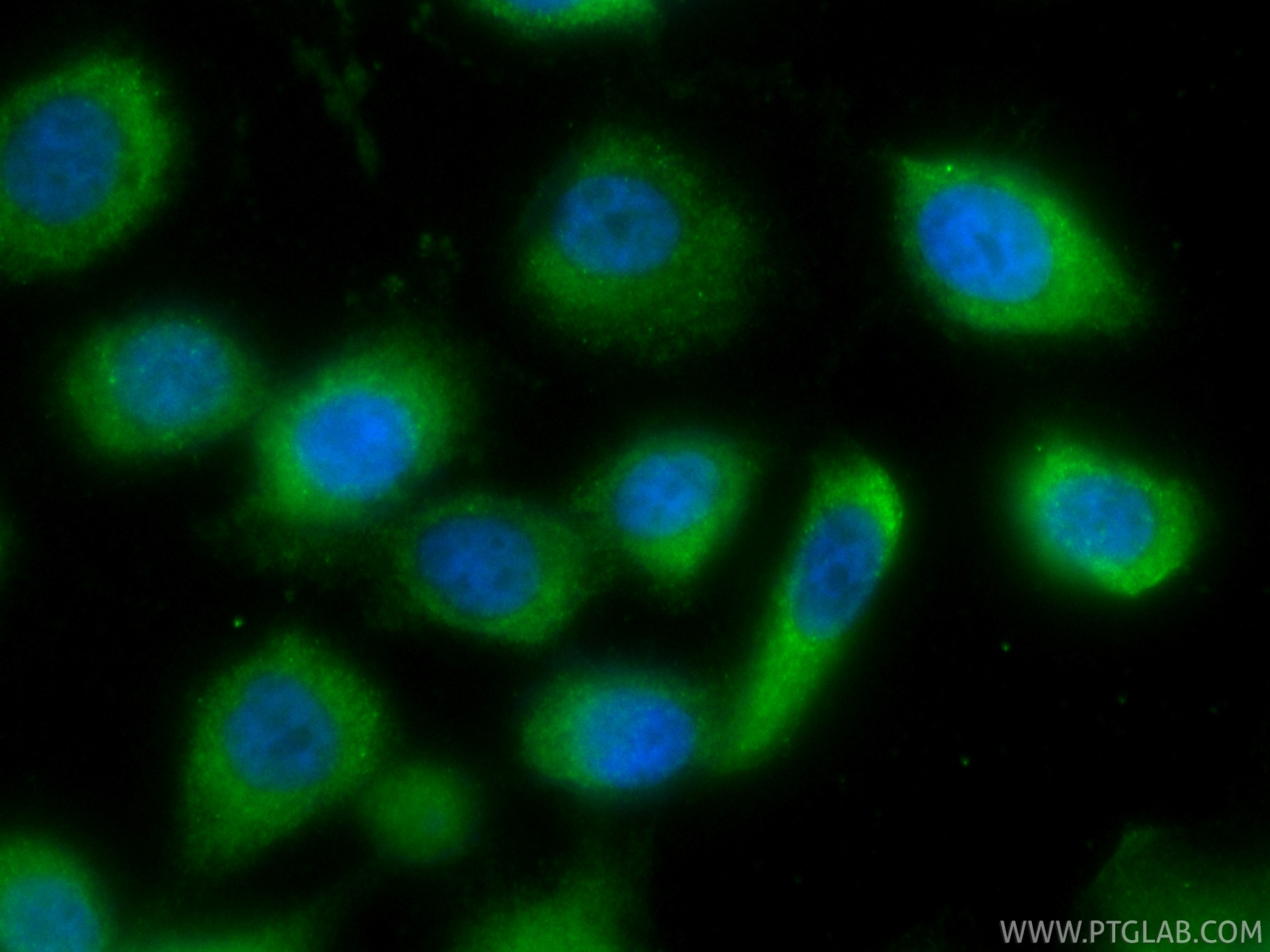 IF Staining of PC-3 using CL488-86333-3