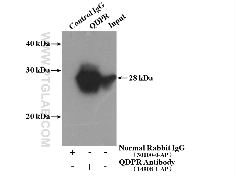 IP experiment of mouse liver using 14908-1-AP